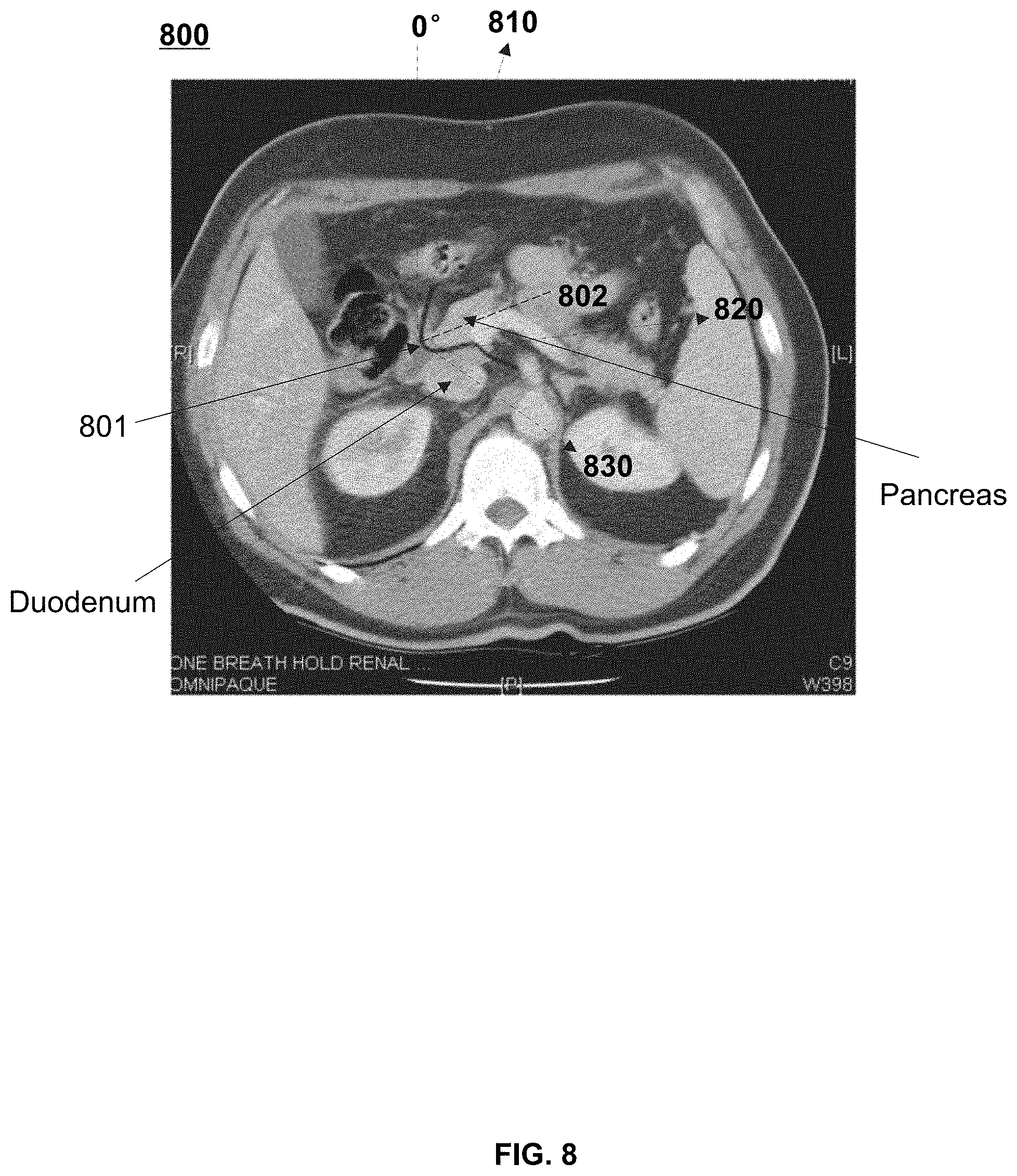 Patent US11779298 Figure 8 – Systems and methods for limited view imaging