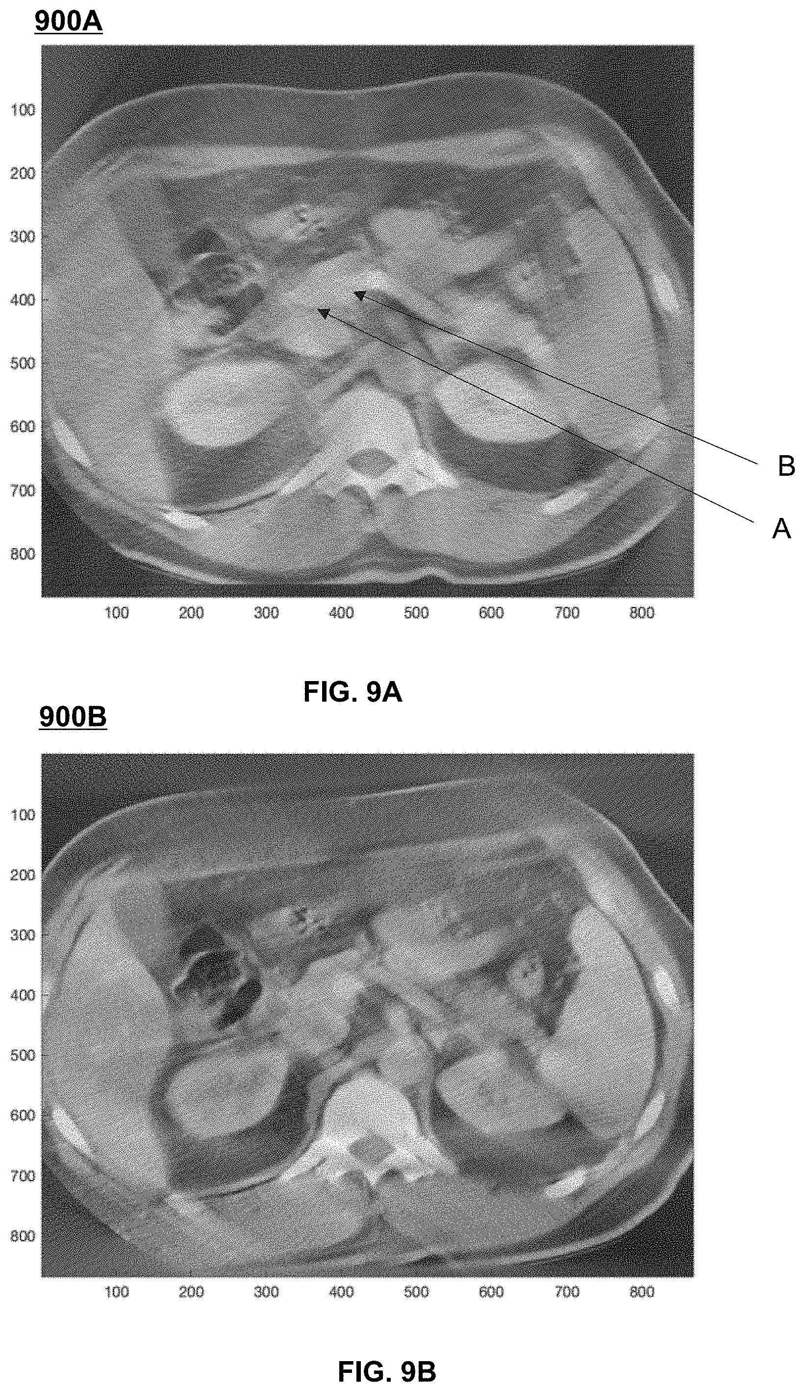Patent US11779298 Figure 9 – Systems and methods for limited view imaging