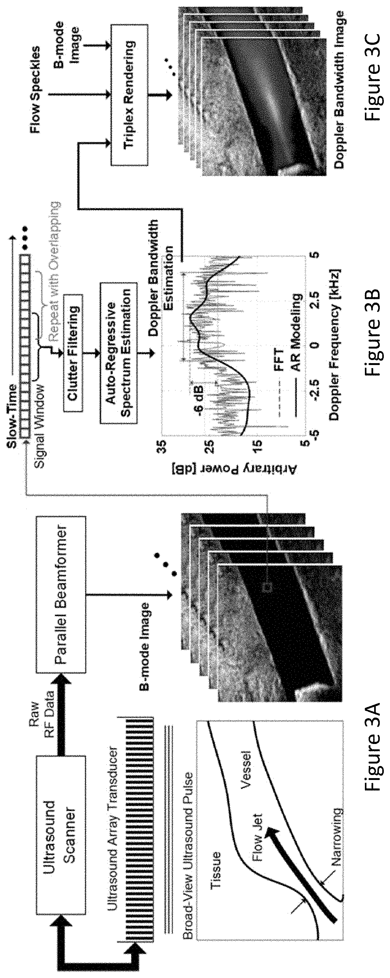 Patent US11779300 Figure 3 – Method and apparatus for detecting flow instability