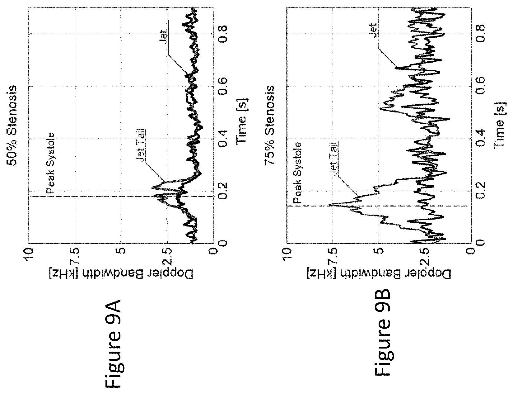 Patent US11779300 Figure 9 – Method and apparatus for detecting flow instability