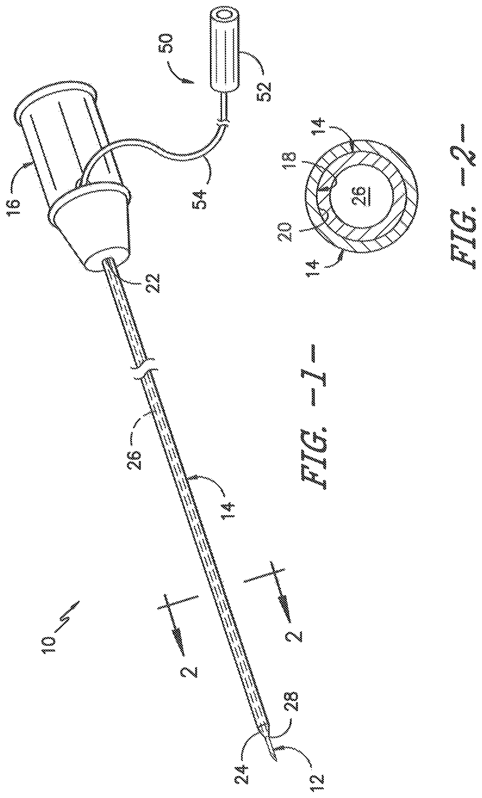 Patent US11779306 Figure 1 – Ultrasonic catheter assembly