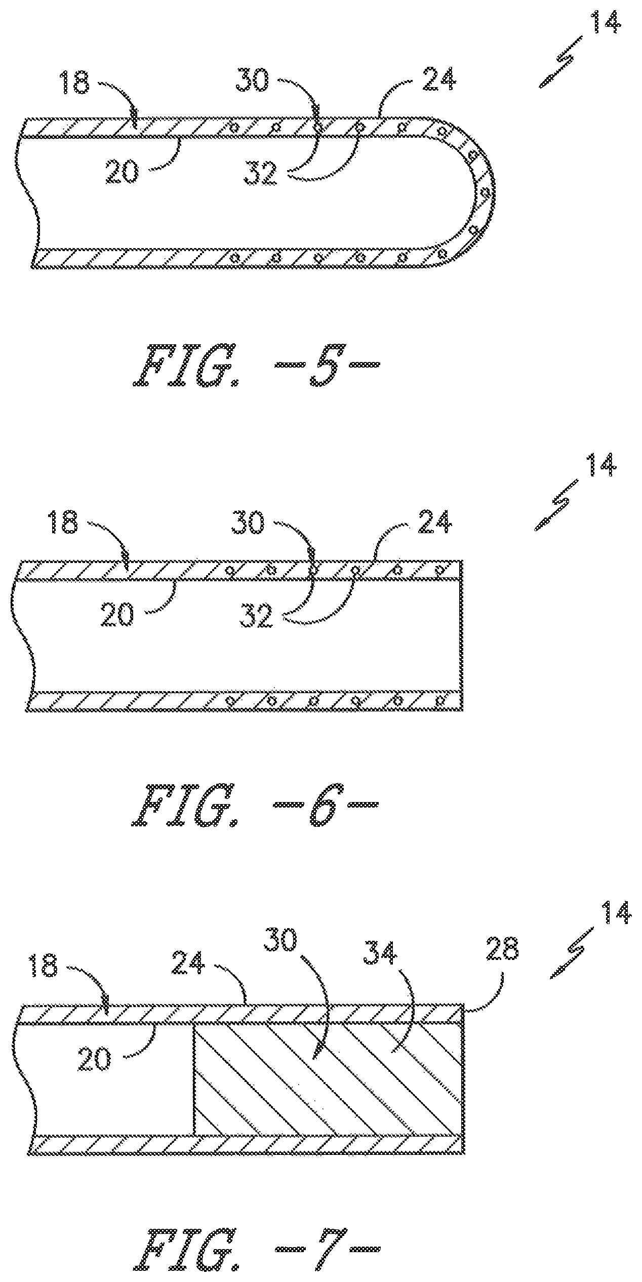 Patent US11779306 Figure 3 – Ultrasonic catheter assembly