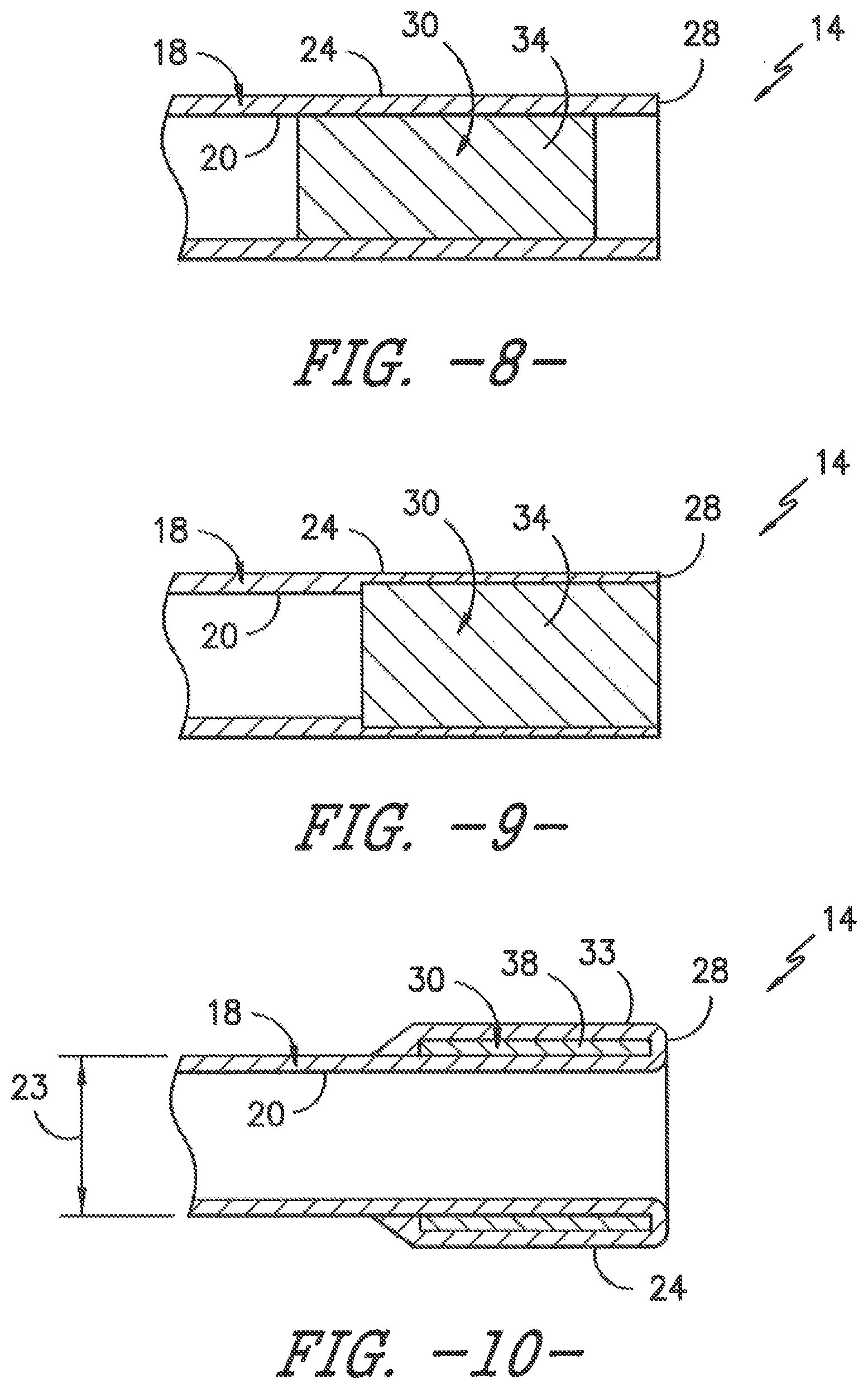 Patent US11779306 Figure 4 – Ultrasonic catheter assembly
