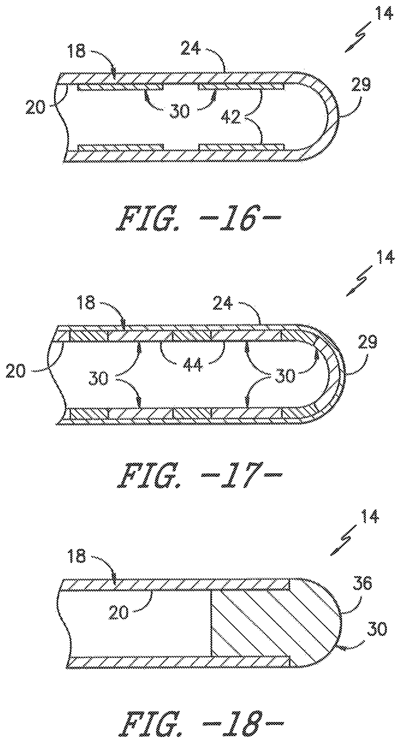 Patent US11779306 Figure 6 – Ultrasonic catheter assembly
