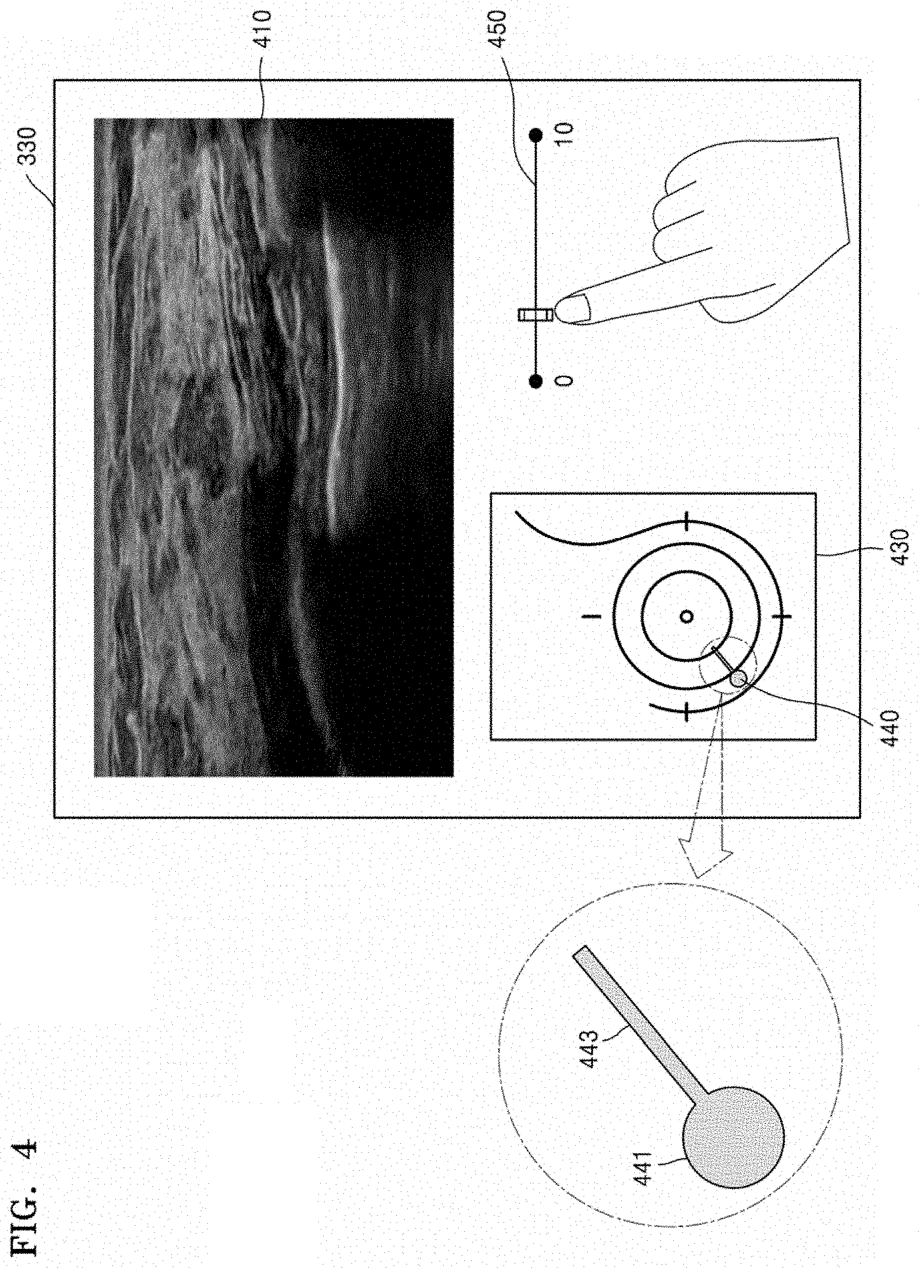 Patent US11779308 Figure 6 – Ultrasound diagnosis apparatus and method of managing ultrasound image obtained thereby