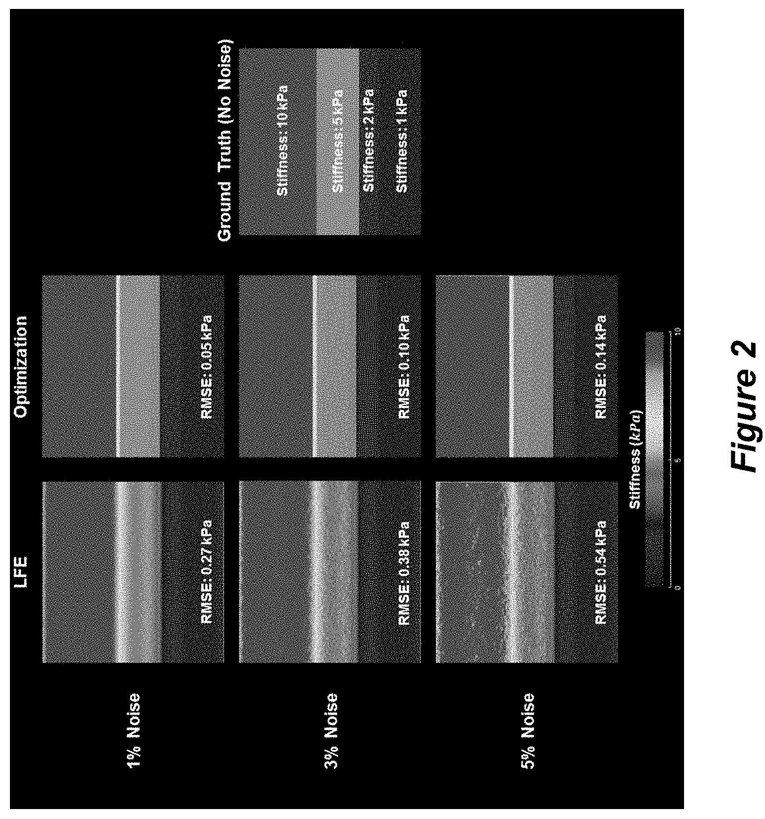 Patent US11779310 Figure 2 – Systems and methods for magnetic resonance elastography with unconstrained optimization inversion