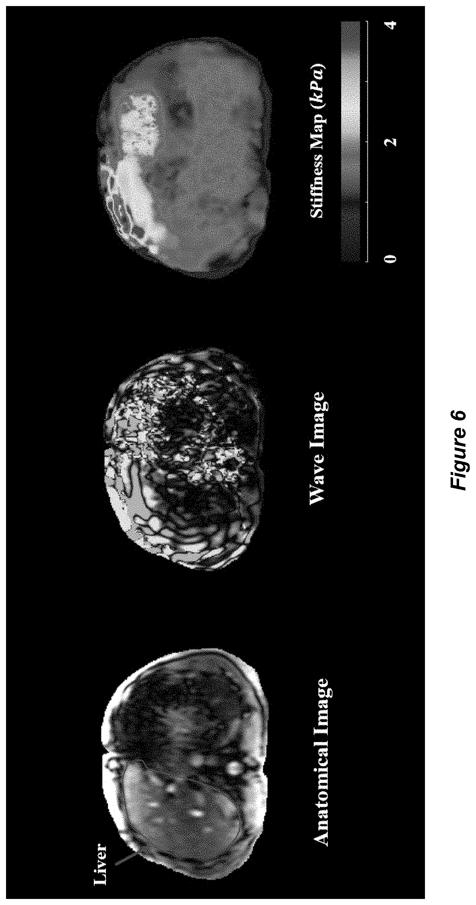 Patent US11779310 Figure 6 – Systems and methods for magnetic resonance elastography with unconstrained optimization inversion