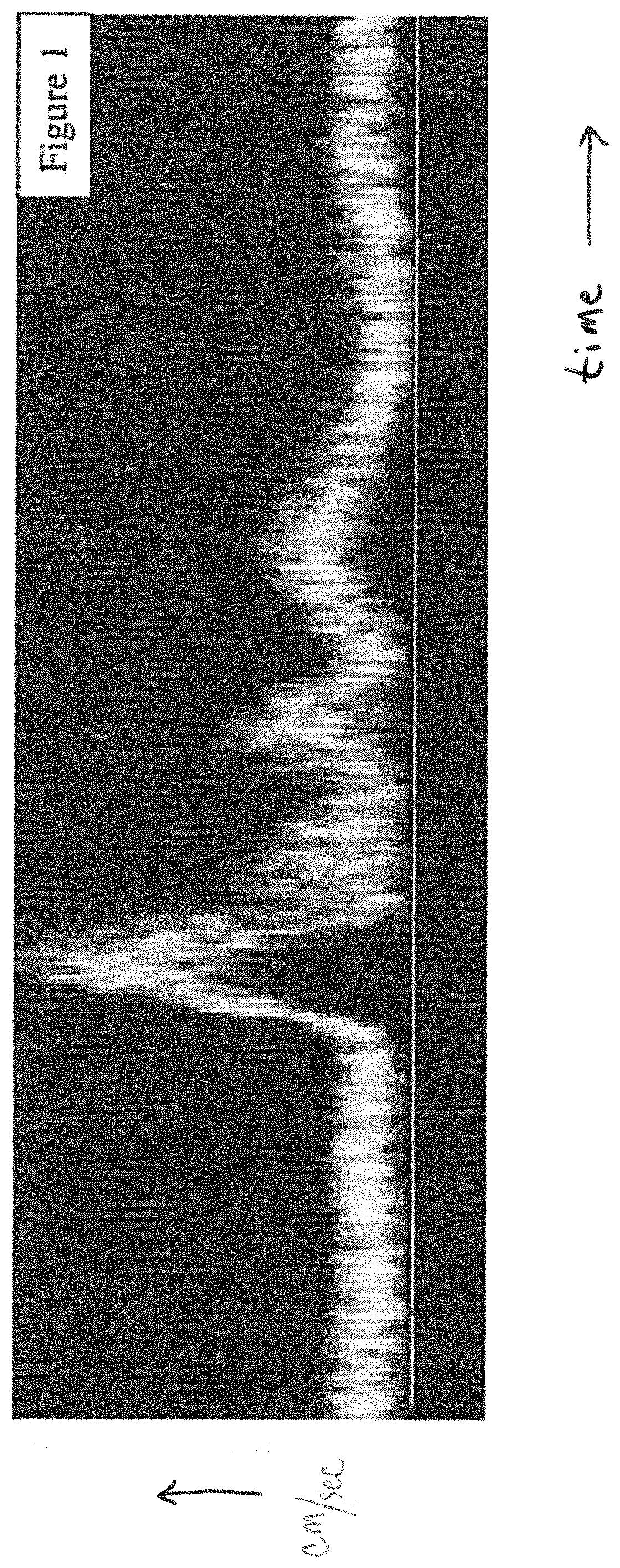 Patent US11779311 Figure 1 – Method and apparatus for performing spectral doppler imaging