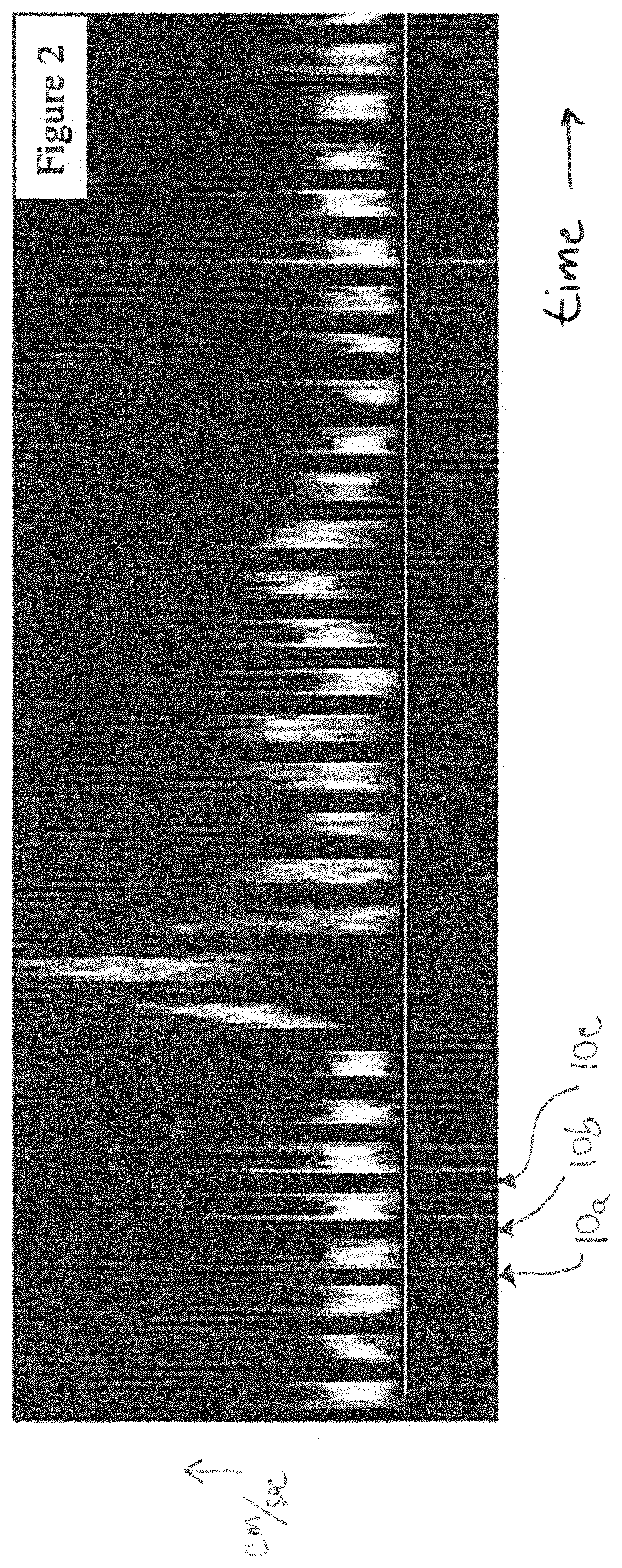 Patent US11779311 Figure 2 – Method and apparatus for performing spectral doppler imaging