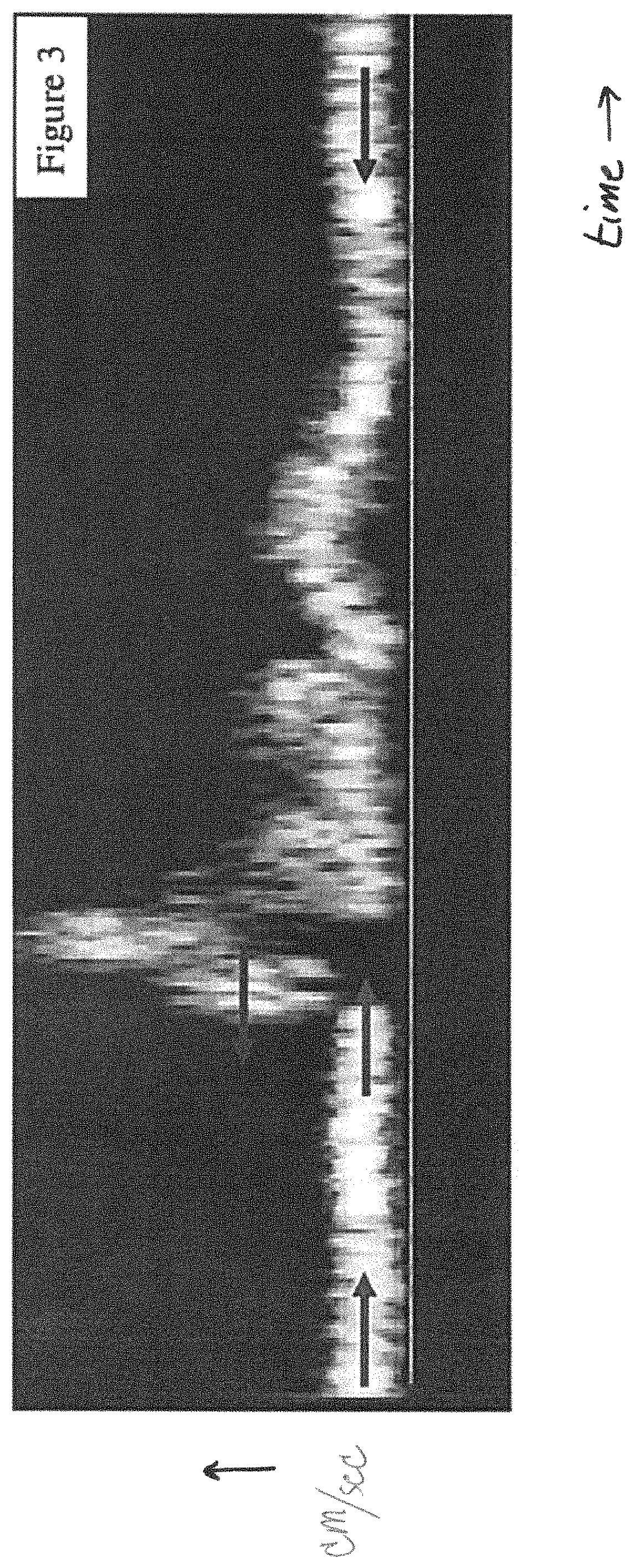 Patent US11779311 Figure 3 – Method and apparatus for performing spectral doppler imaging