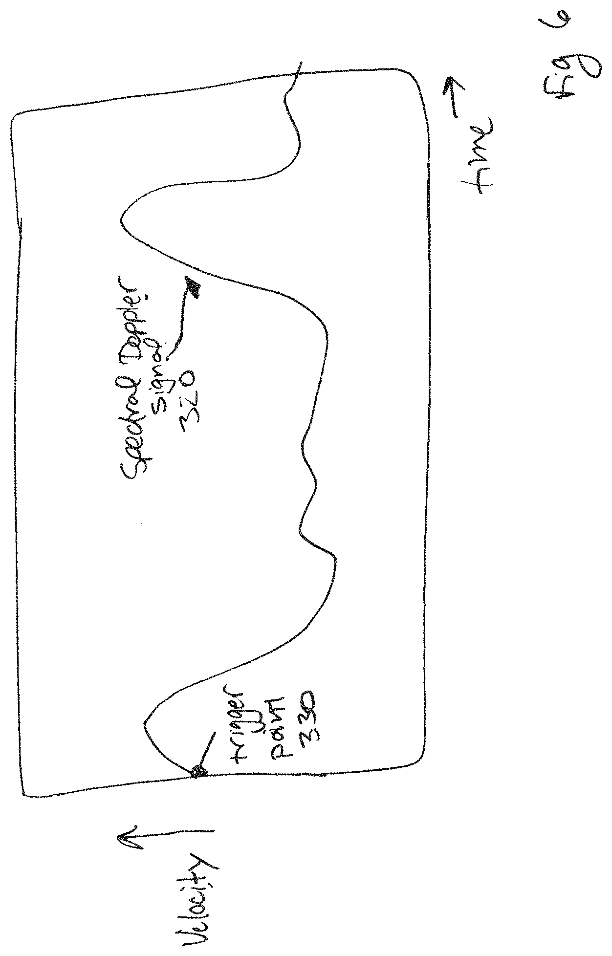 Patent US11779311 Figure 6 – Method and apparatus for performing spectral doppler imaging