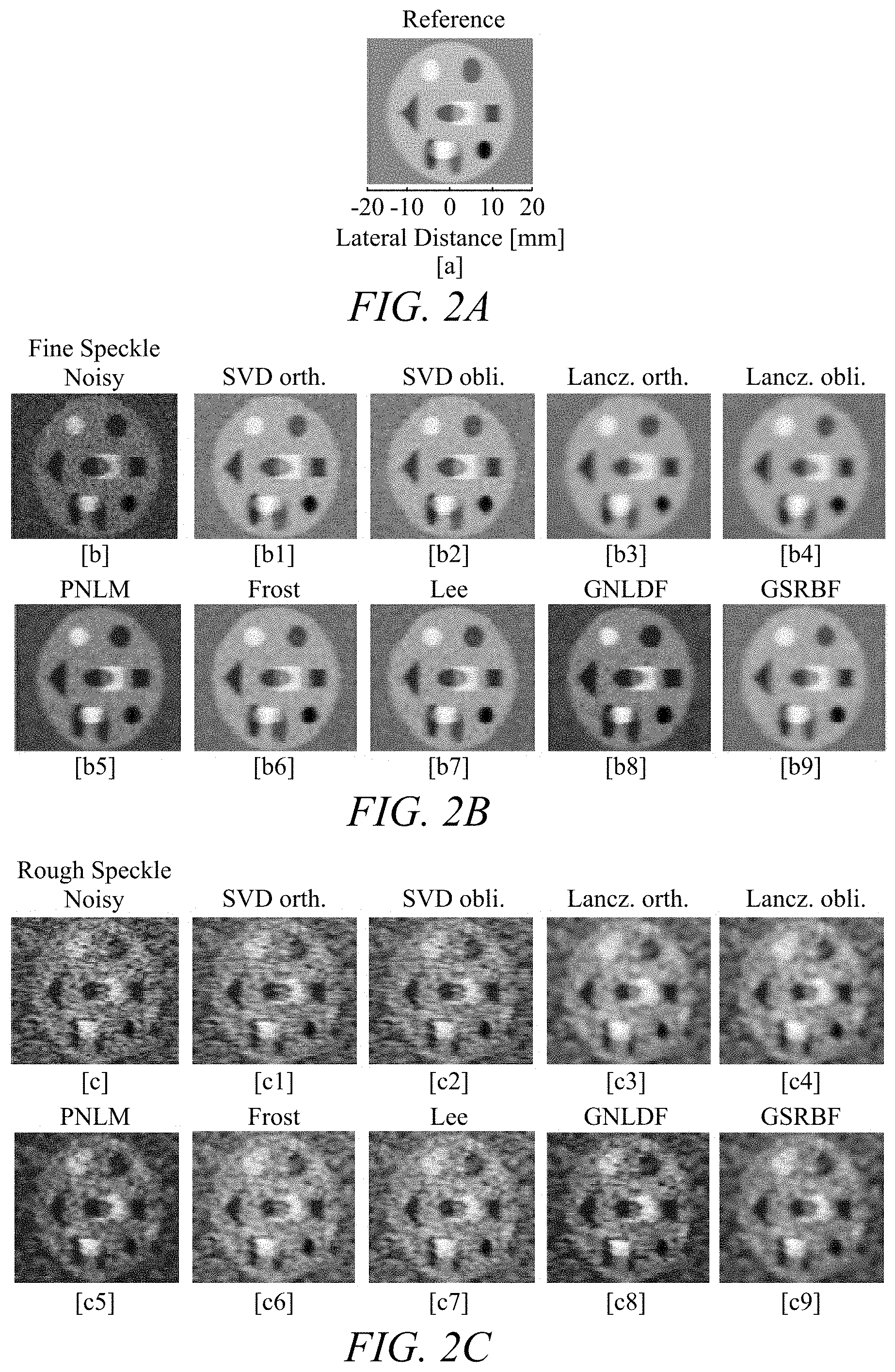 Patent US11779313 Figure 2 – Suppressing speckle noise in medical ultrasound images
