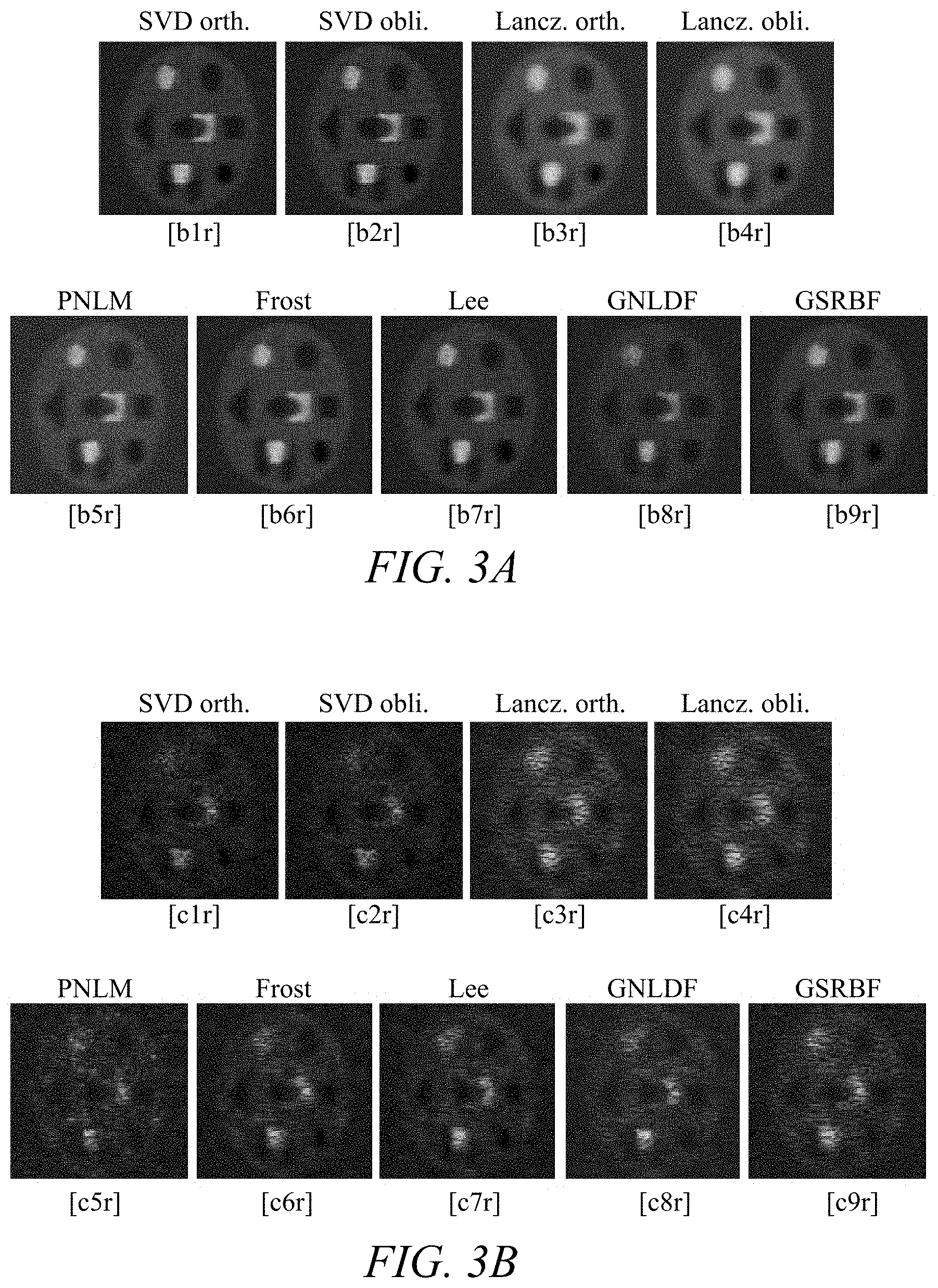 Patent US11779313 Figure 3 – Suppressing speckle noise in medical ultrasound images