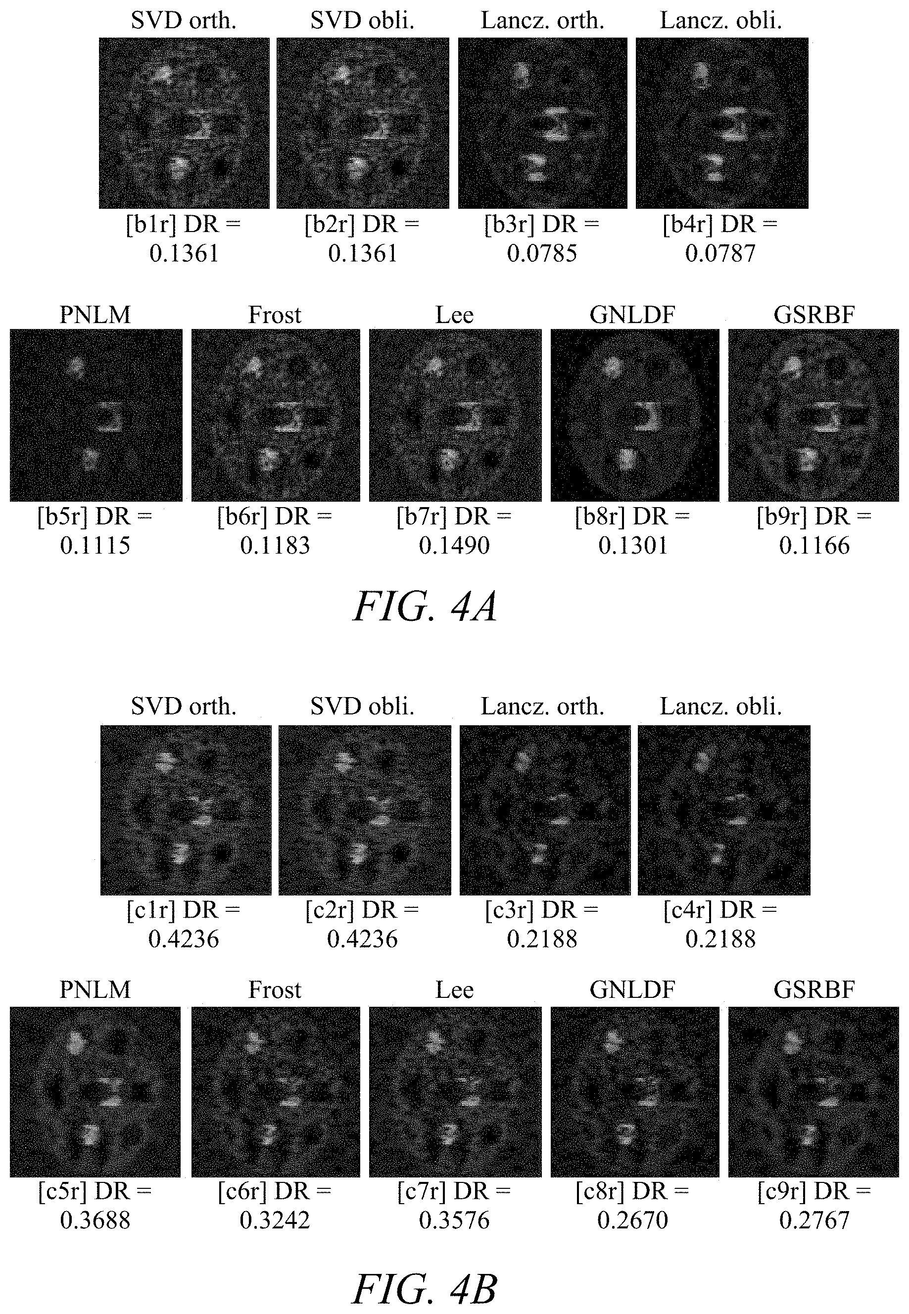 Patent US11779313 Figure 4 – Suppressing speckle noise in medical ultrasound images