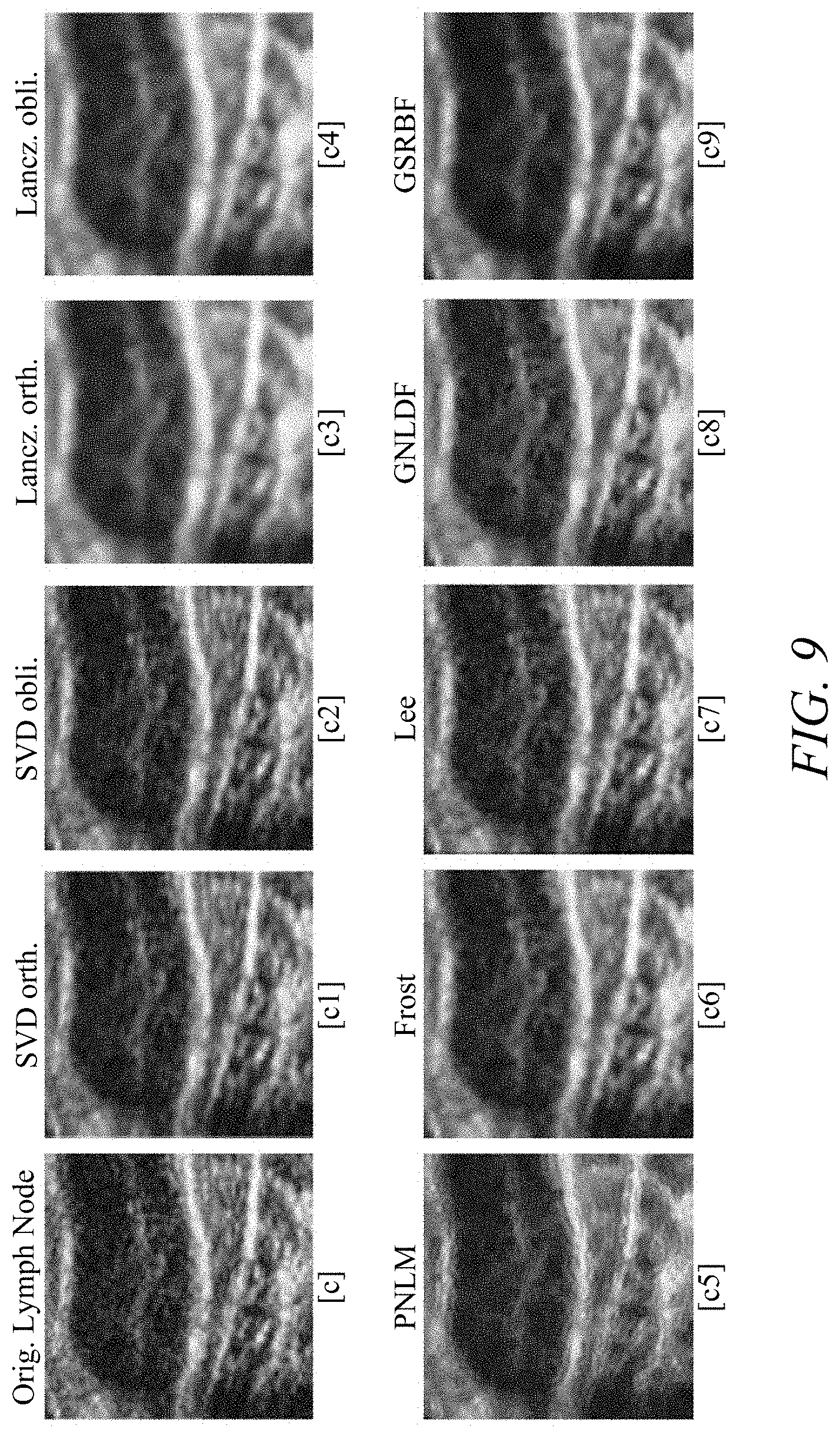 Patent US11779313 Figure 13 – Suppressing speckle noise in medical ultrasound images