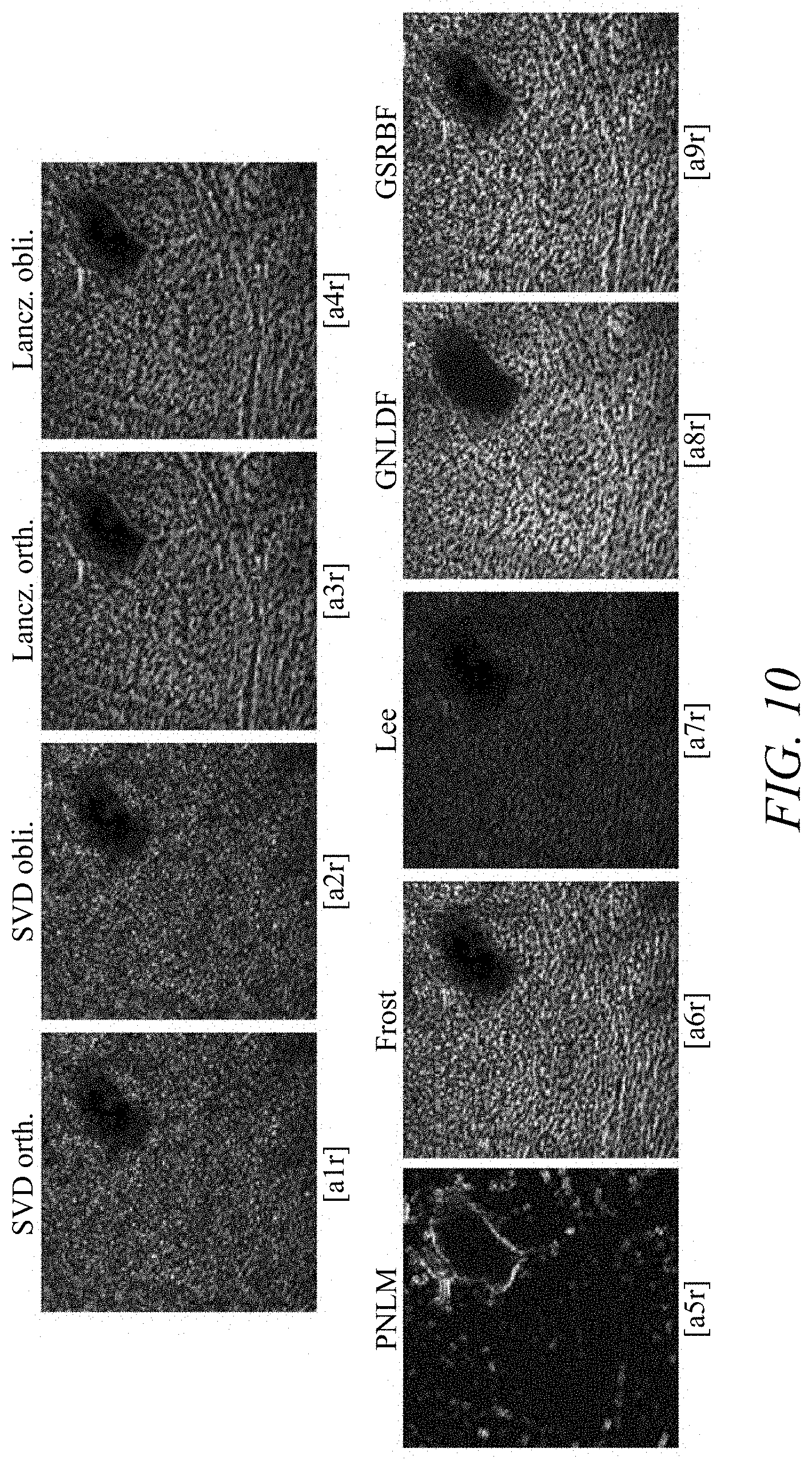 Patent US11779313 Figure 14 – Suppressing speckle noise in medical ultrasound images