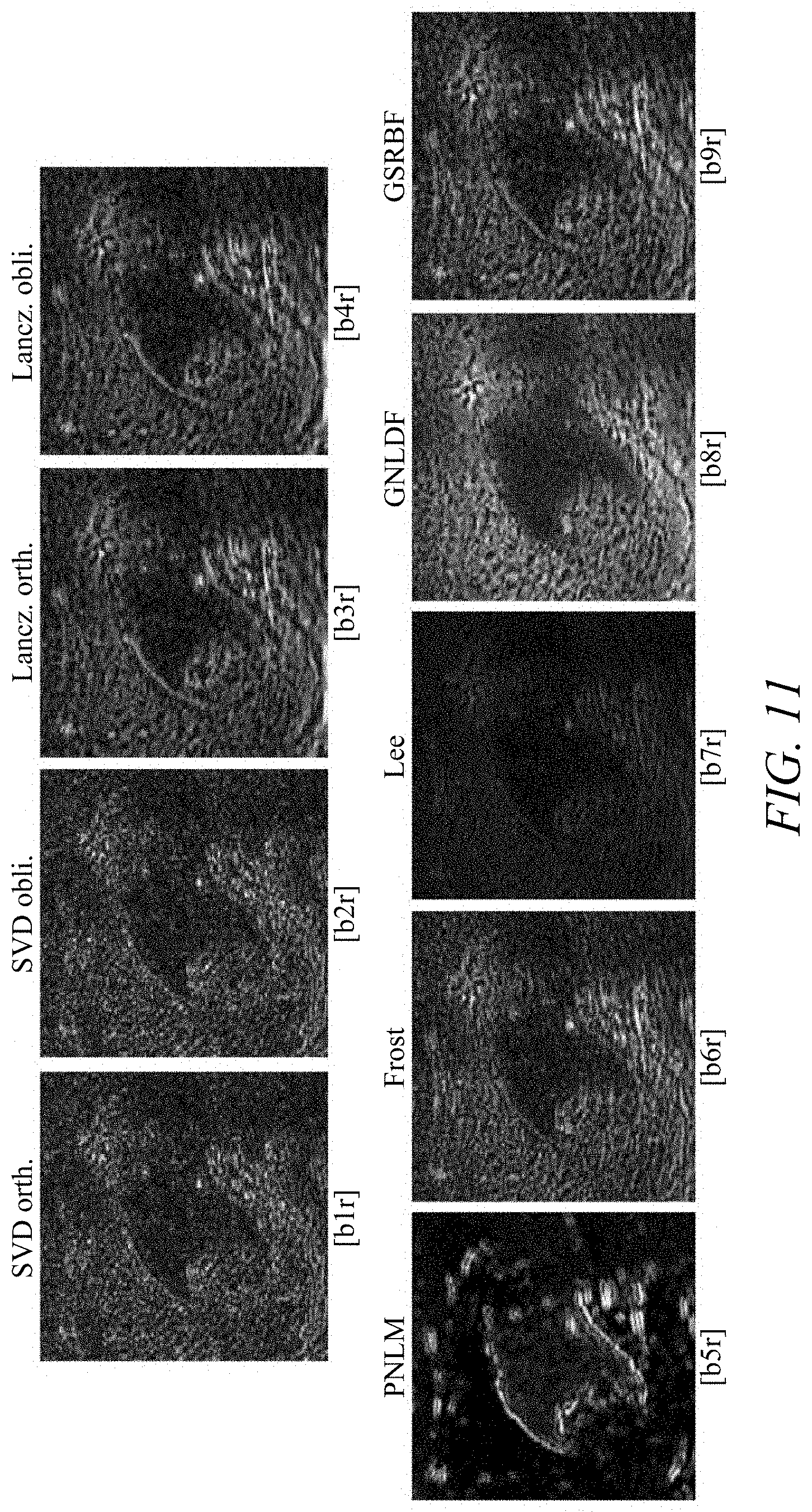 Patent US11779313 Figure 15 – Suppressing speckle noise in medical ultrasound images