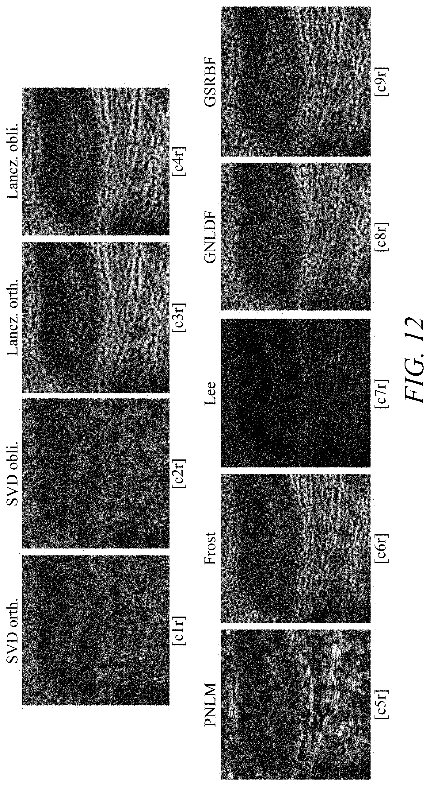 Patent US11779313 Figure 16 – Suppressing speckle noise in medical ultrasound images