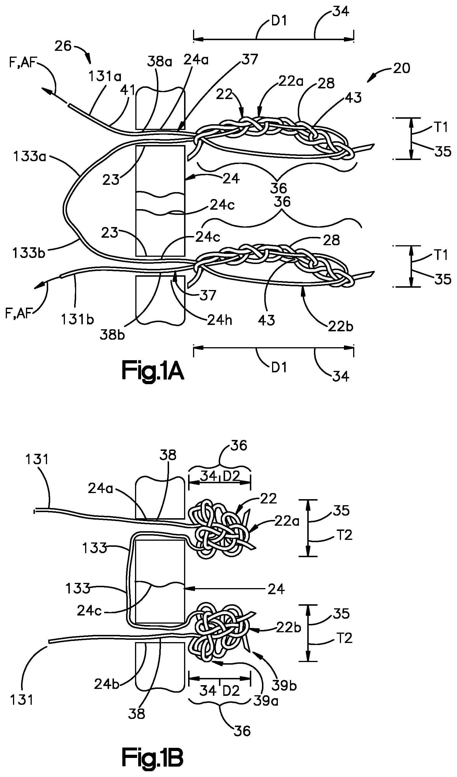 Patent US11779318 Figure 1 – Insertion instrument for anchor assembly