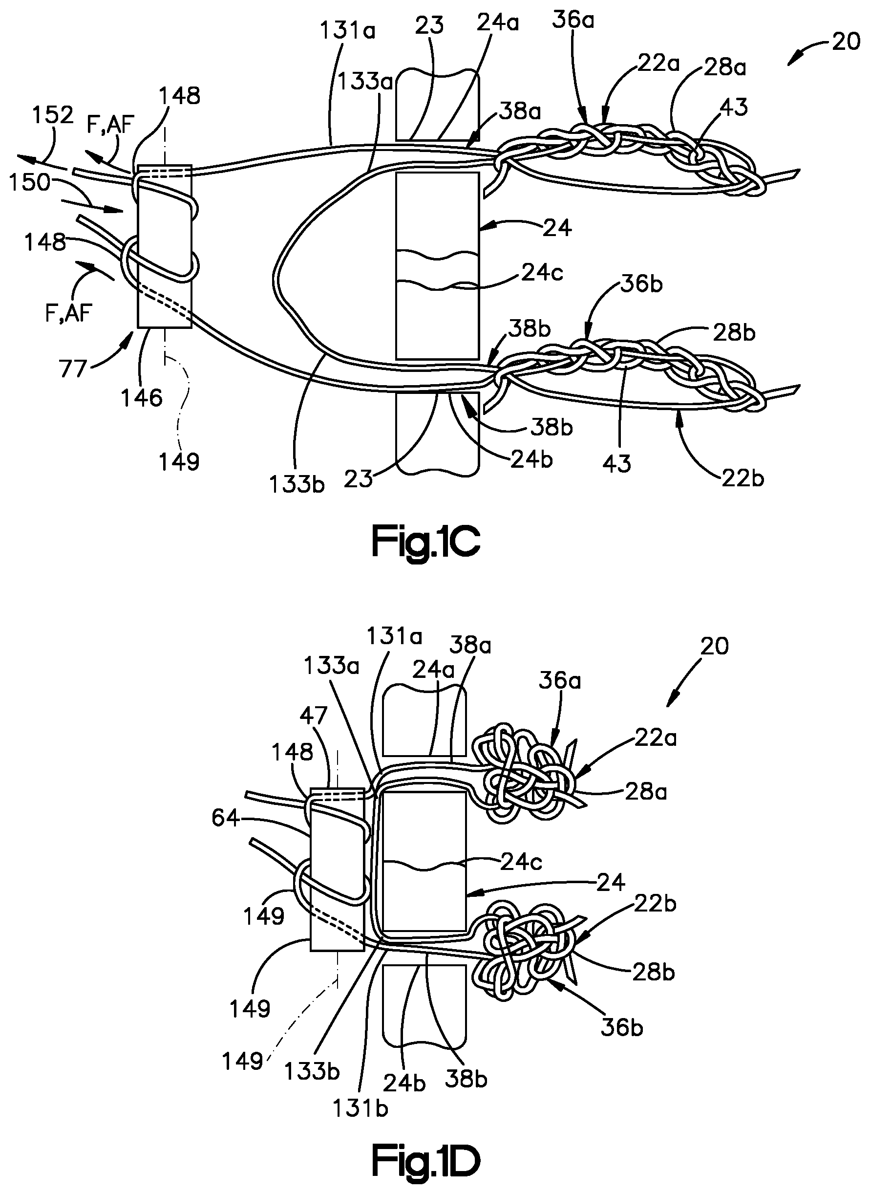 Patent US11779318 Figure 2 – Insertion instrument for anchor assembly