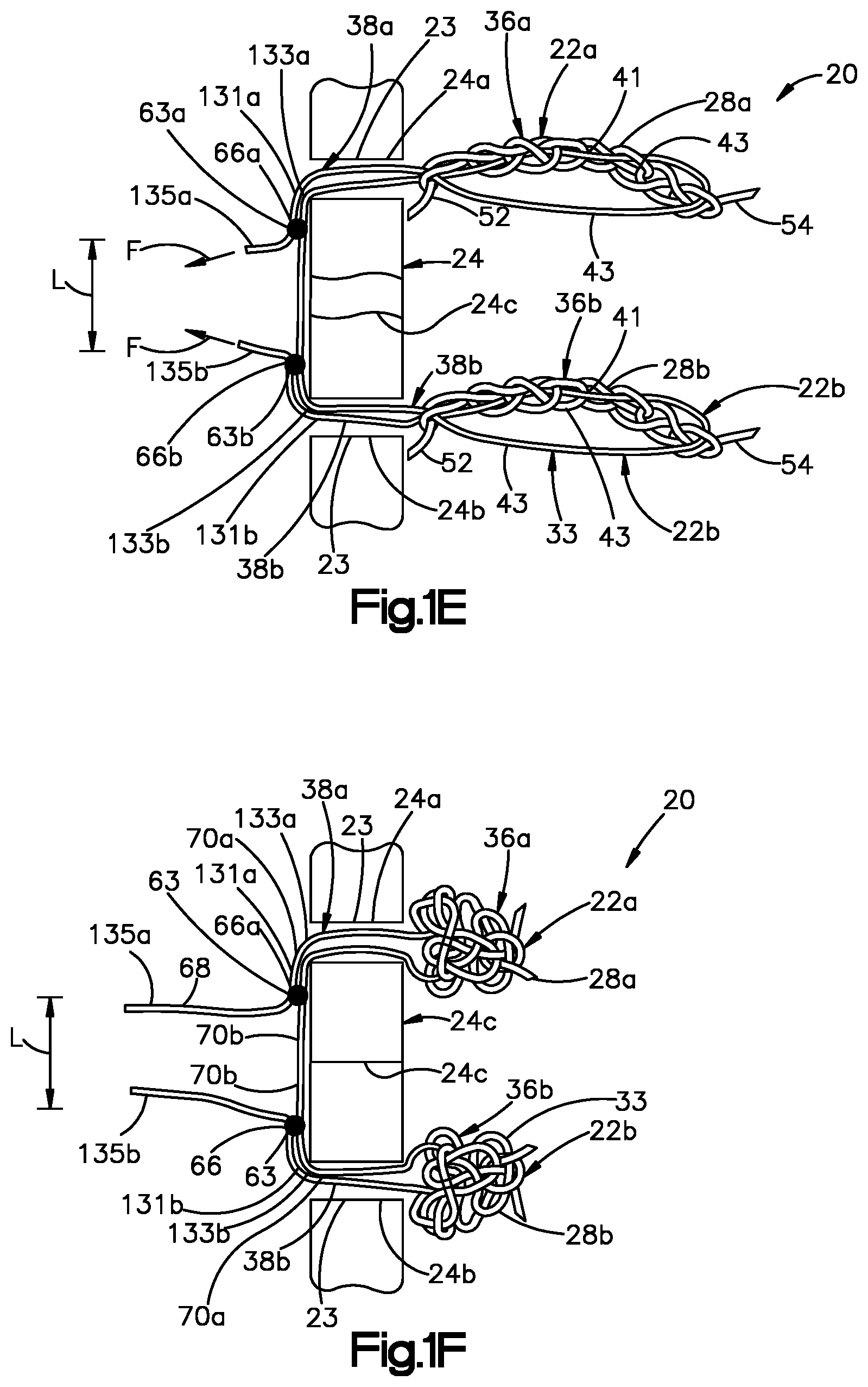 Patent US11779318 Figure 3 – Insertion instrument for anchor assembly