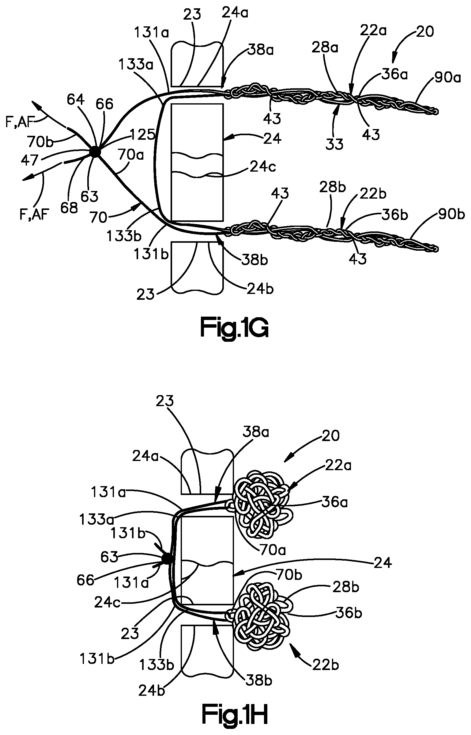 Patent US11779318 Figure 4 – Insertion instrument for anchor assembly