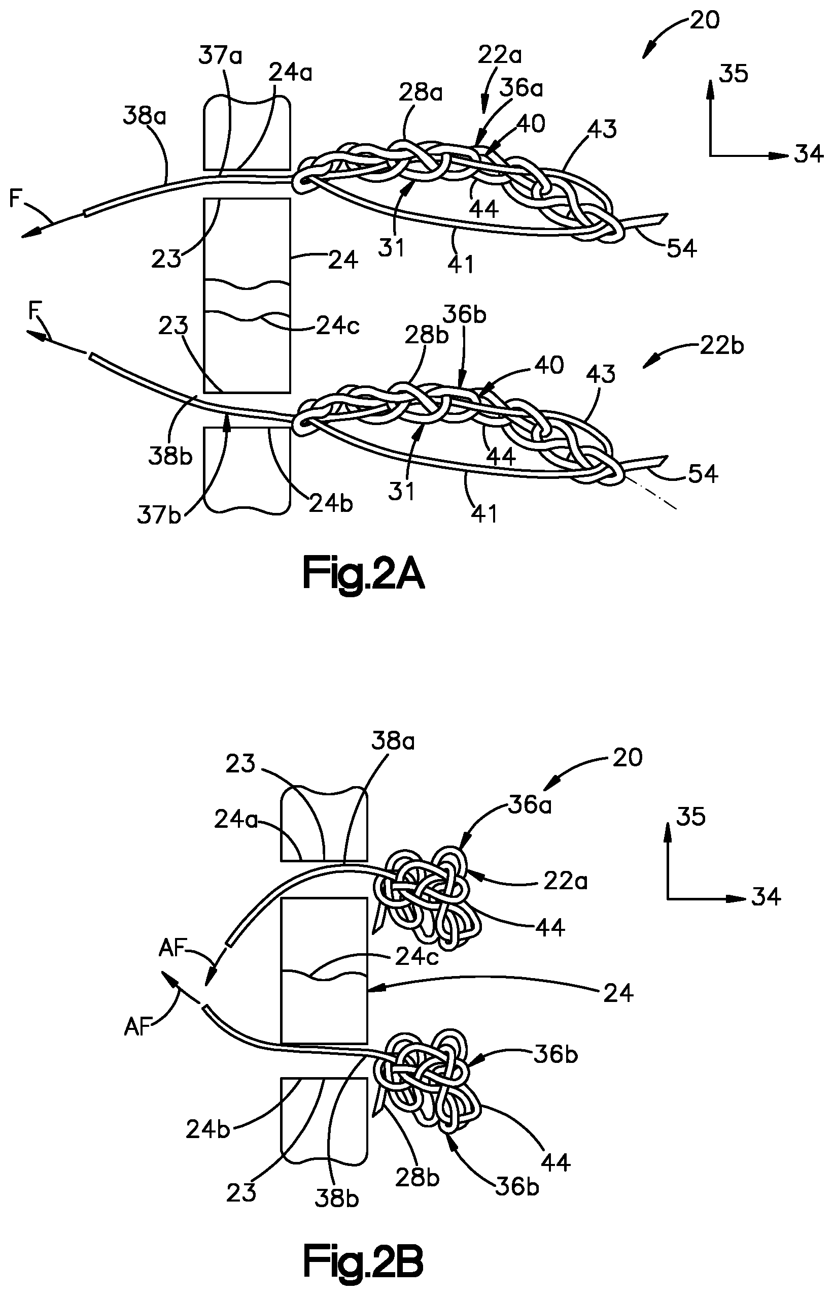 Patent US11779318 Figure 5 – Insertion instrument for anchor assembly