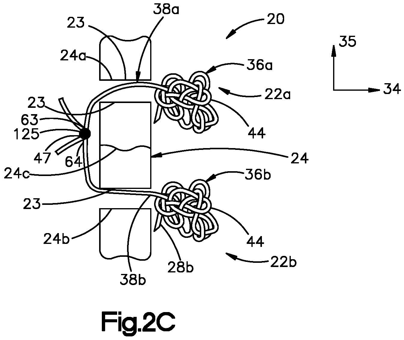 Patent US11779318 Figure 6 – Insertion instrument for anchor assembly