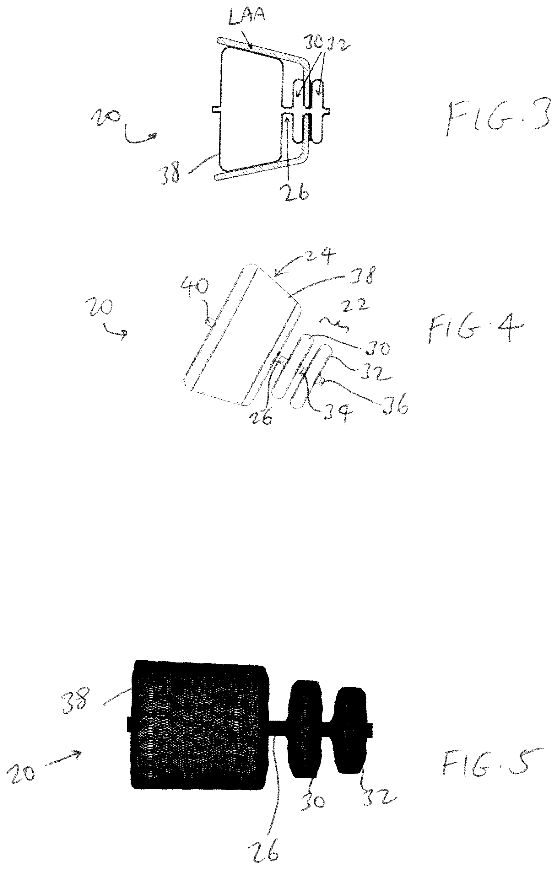 Patent US11779319 Figure 2 – Method and device for left atrial appendage closure