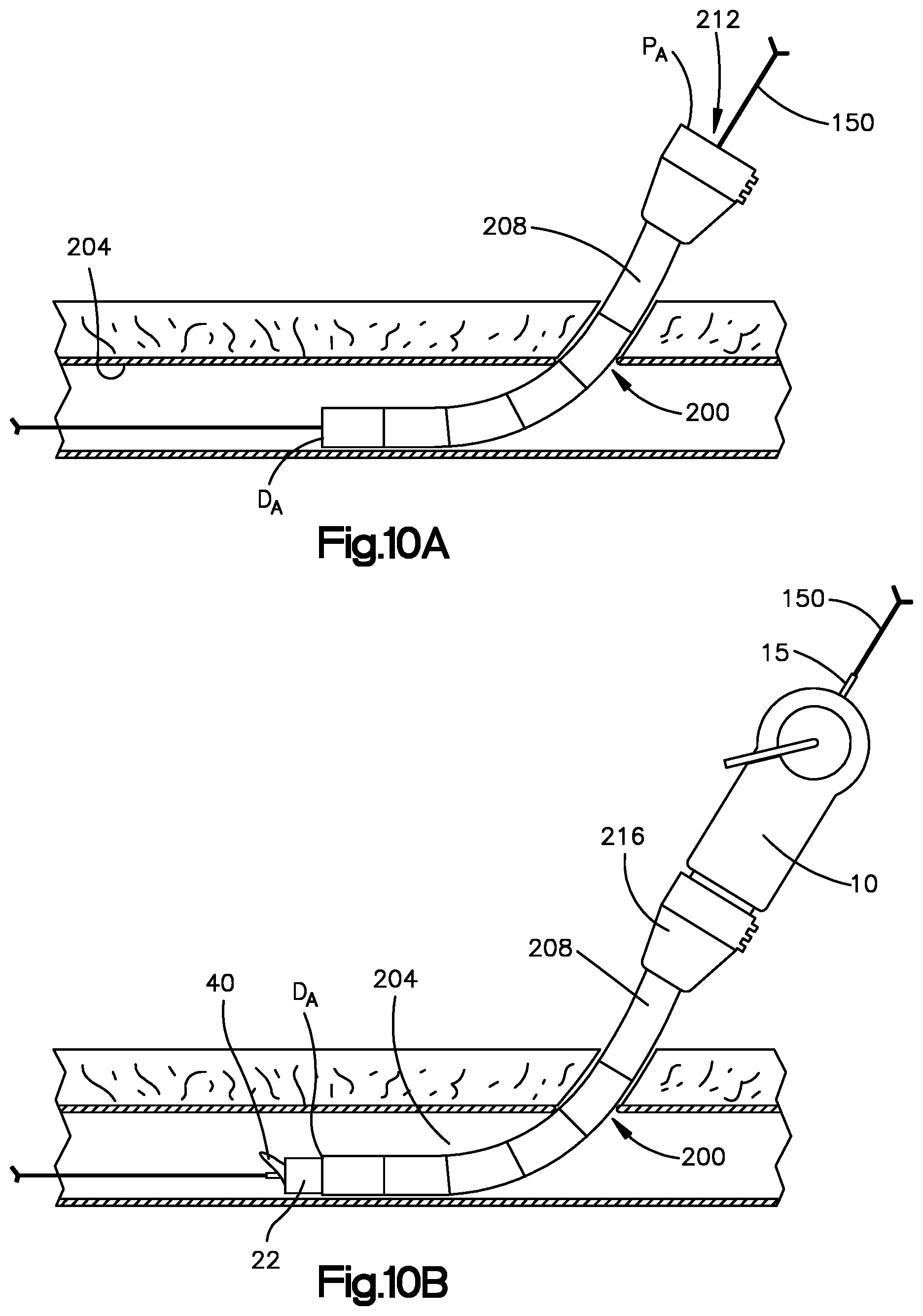 Patent US11779320 Figure 11 – Vascular closure device