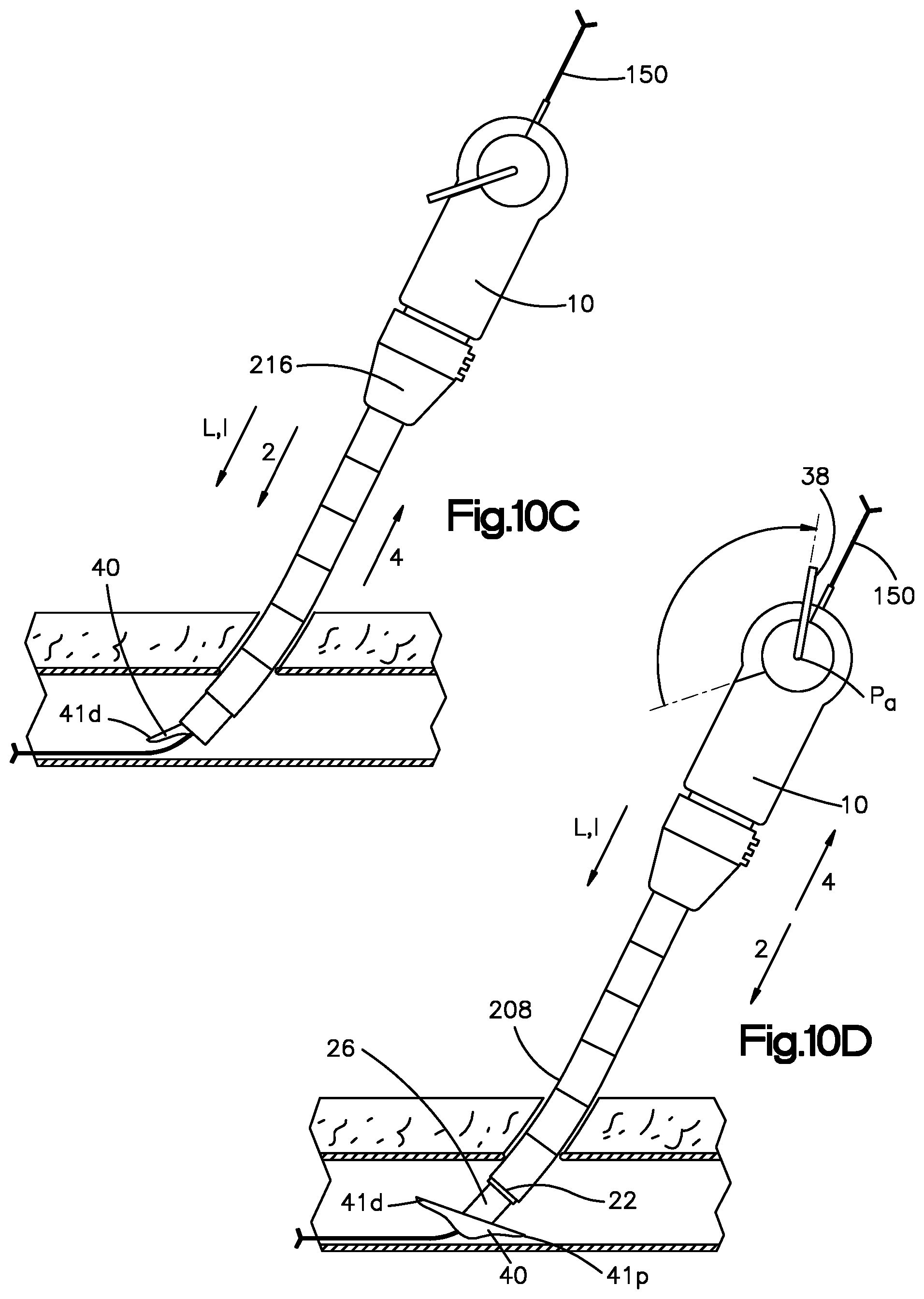 Patent US11779320 Figure 12 – Vascular closure device