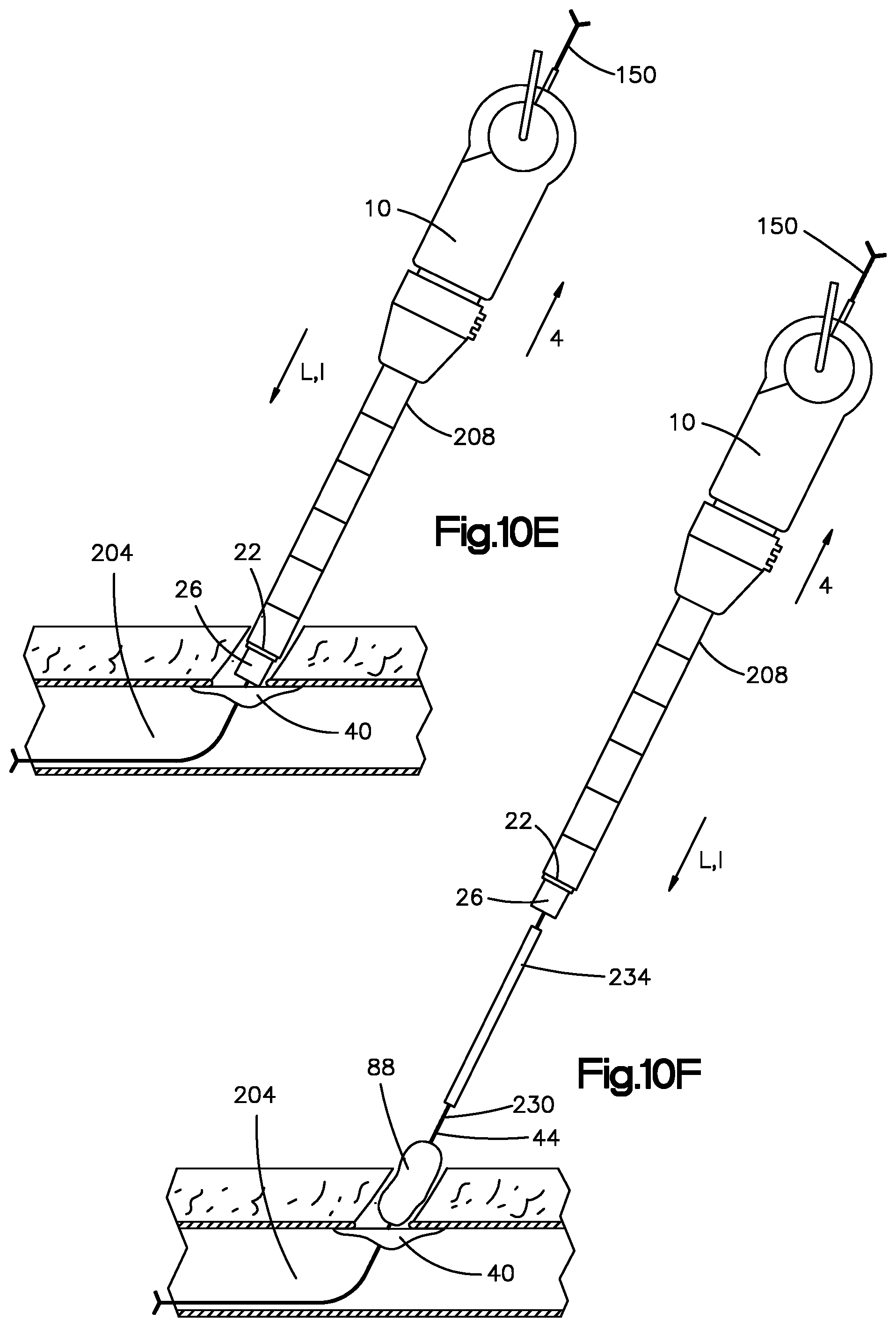 Patent US11779320 Figure 13 – Vascular closure device