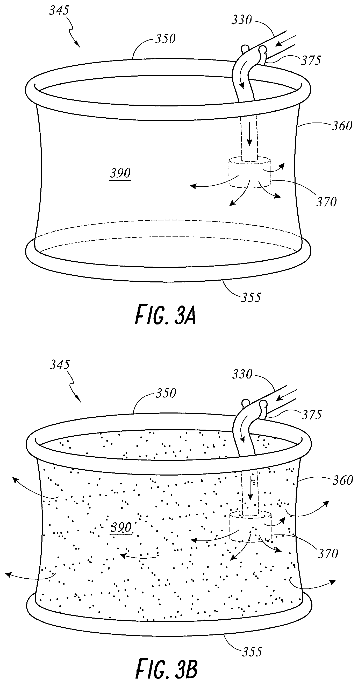 Patent US11779321 Figure 3 – Wound retractor and diffuser