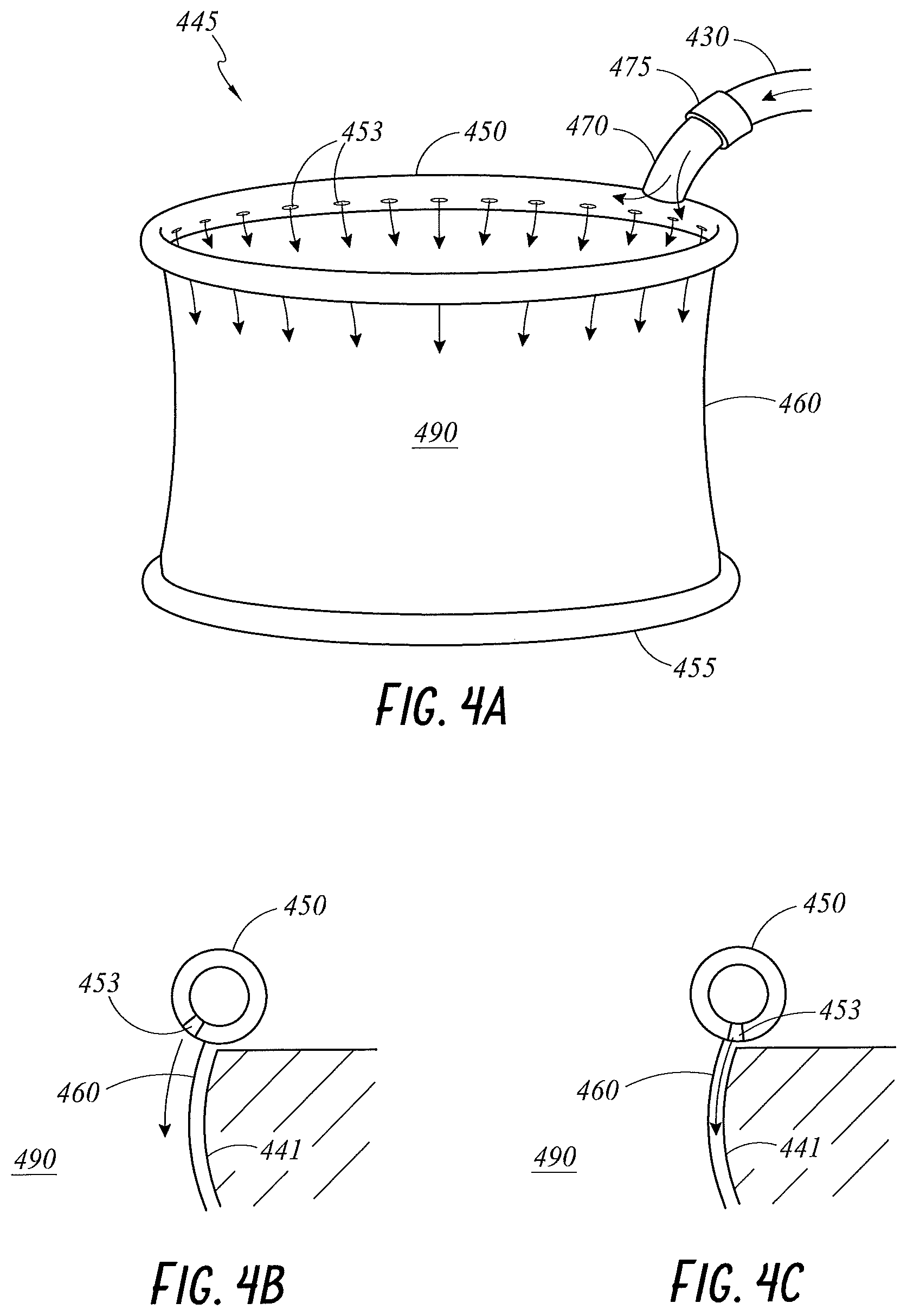Patent US11779321 Figure 4 – Wound retractor and diffuser