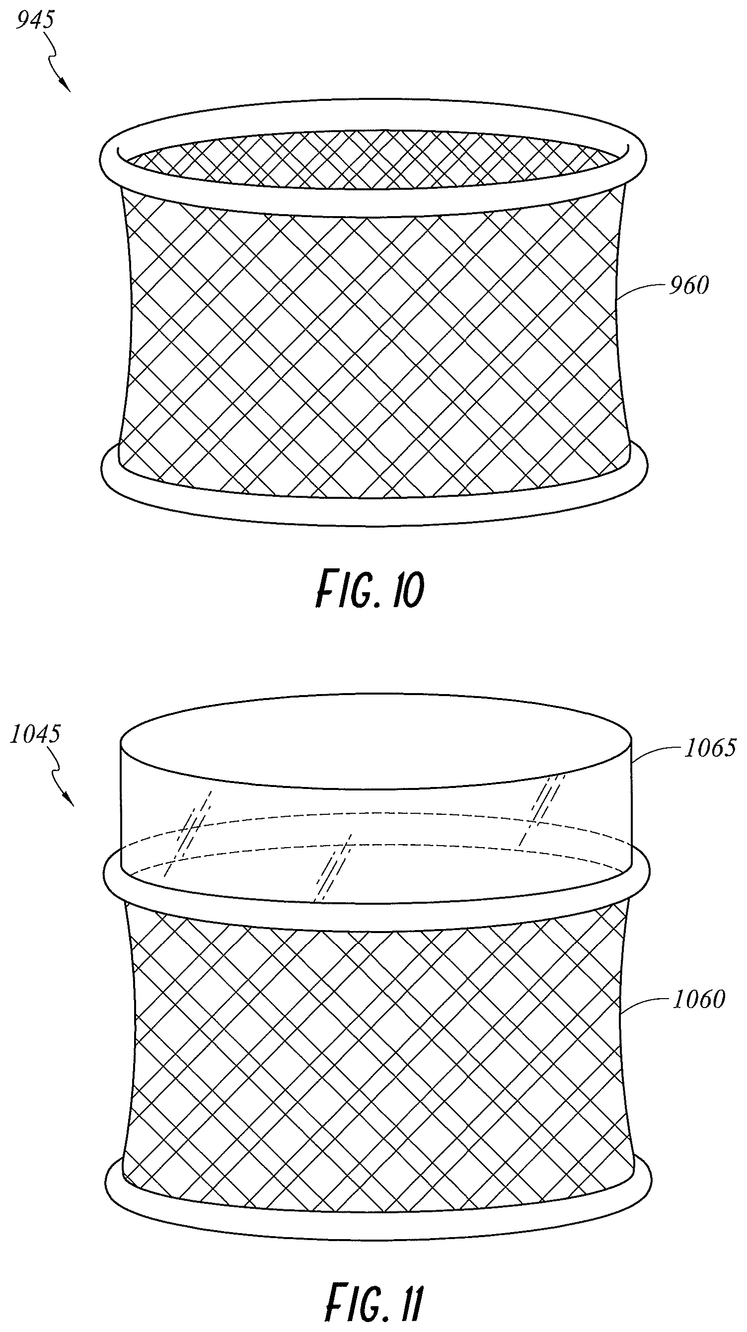 Patent US11779321 Figure 10 – Wound retractor and diffuser