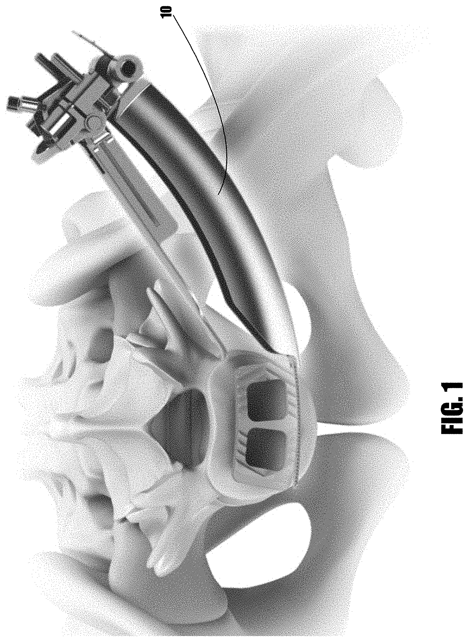 Patent US11779322 Figure 1 – Methods and devices for surgical access