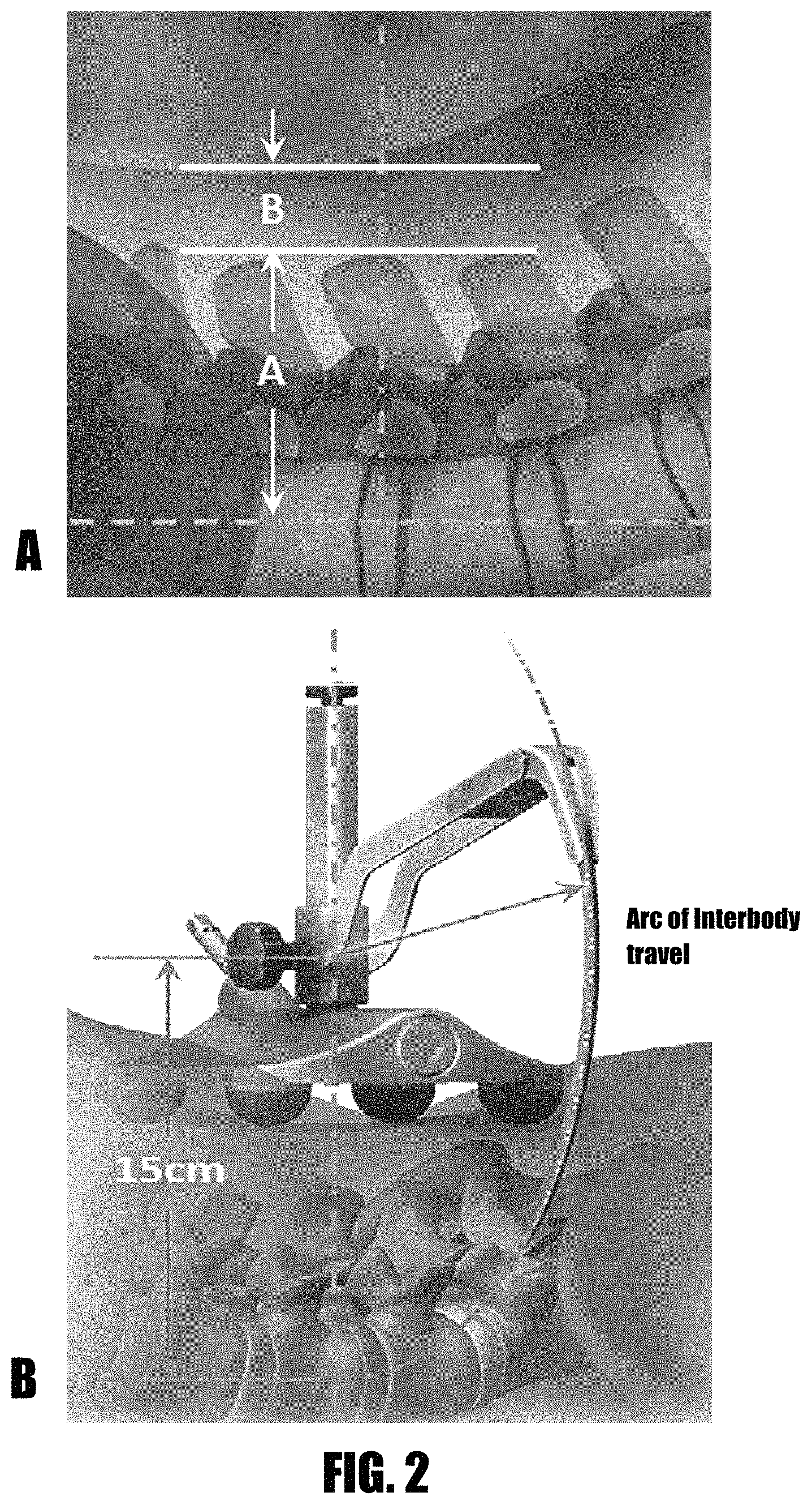 Patent US11779322 Figure 2 – Methods and devices for surgical access