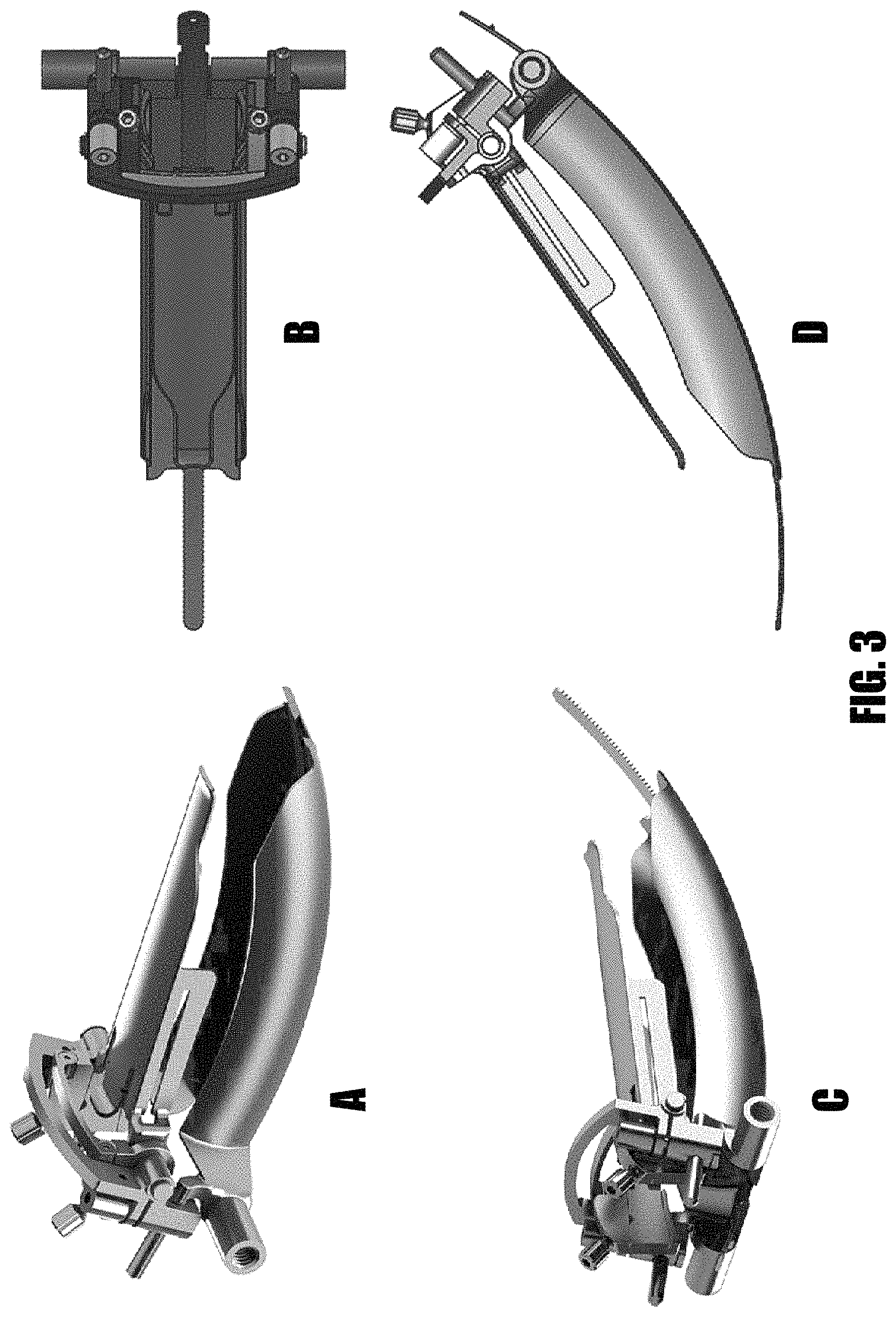 Patent US11779322 Figure 3 – Methods and devices for surgical access