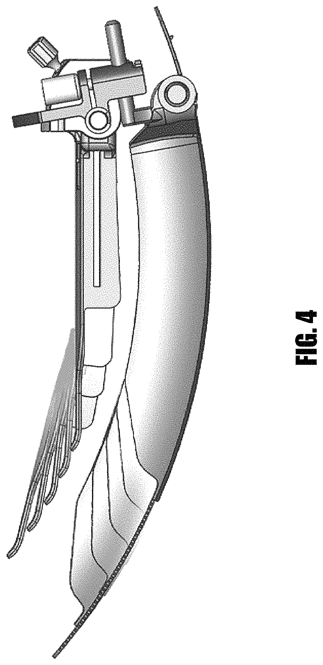 Patent US11779322 Figure 4 – Methods and devices for surgical access