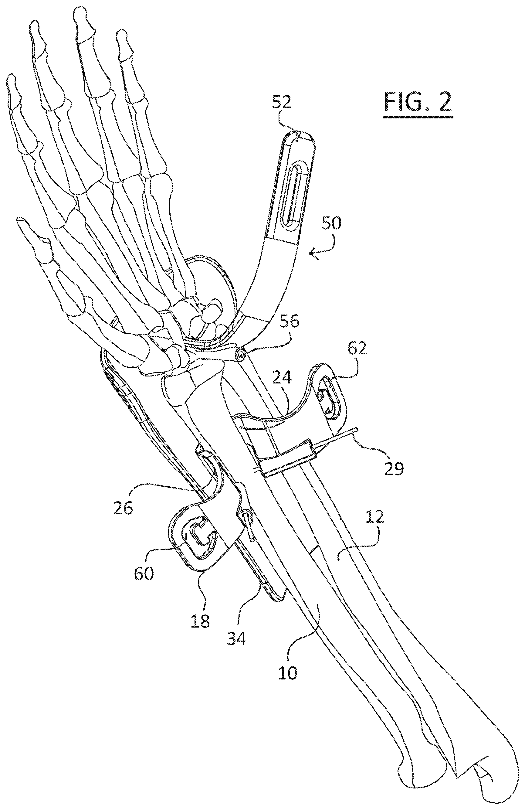 Patent US11779323 Figure 2 – Single use radiolucent stabilizing retractor system