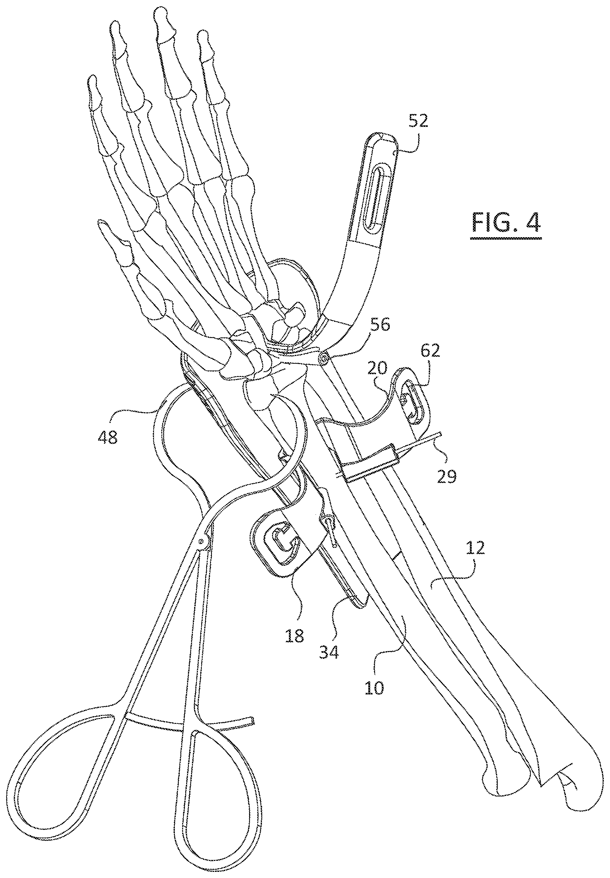 Patent US11779323 Figure 4 – Single use radiolucent stabilizing retractor system