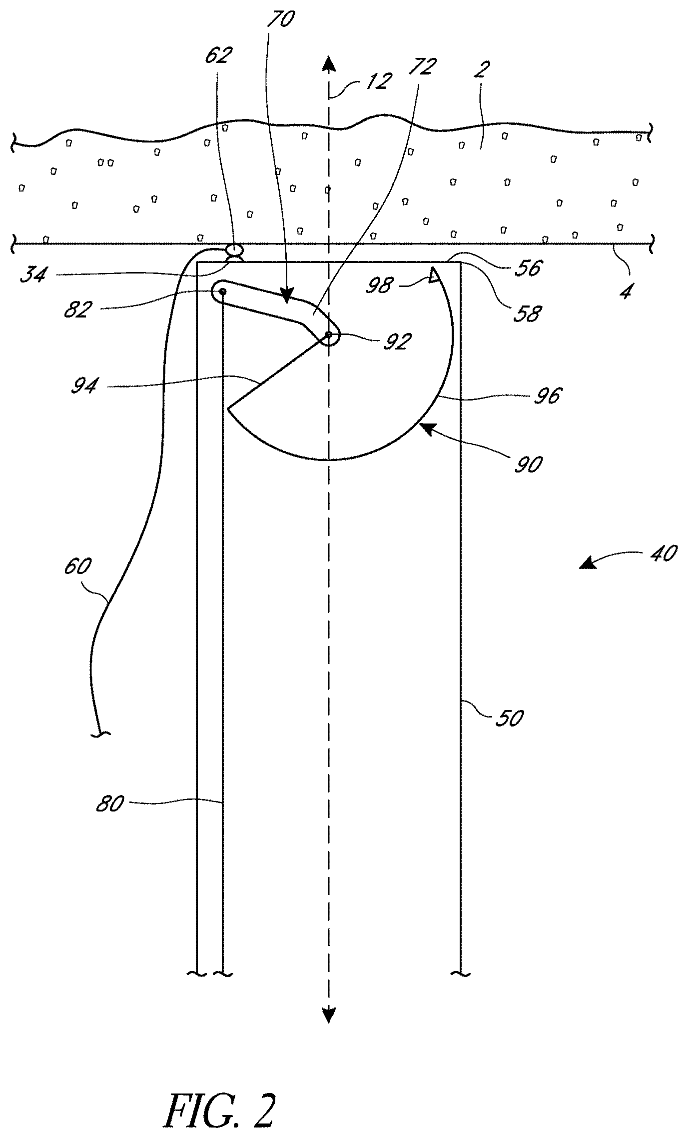 Patent US11779324 Figure 2 – Suturing methods and apparatuses