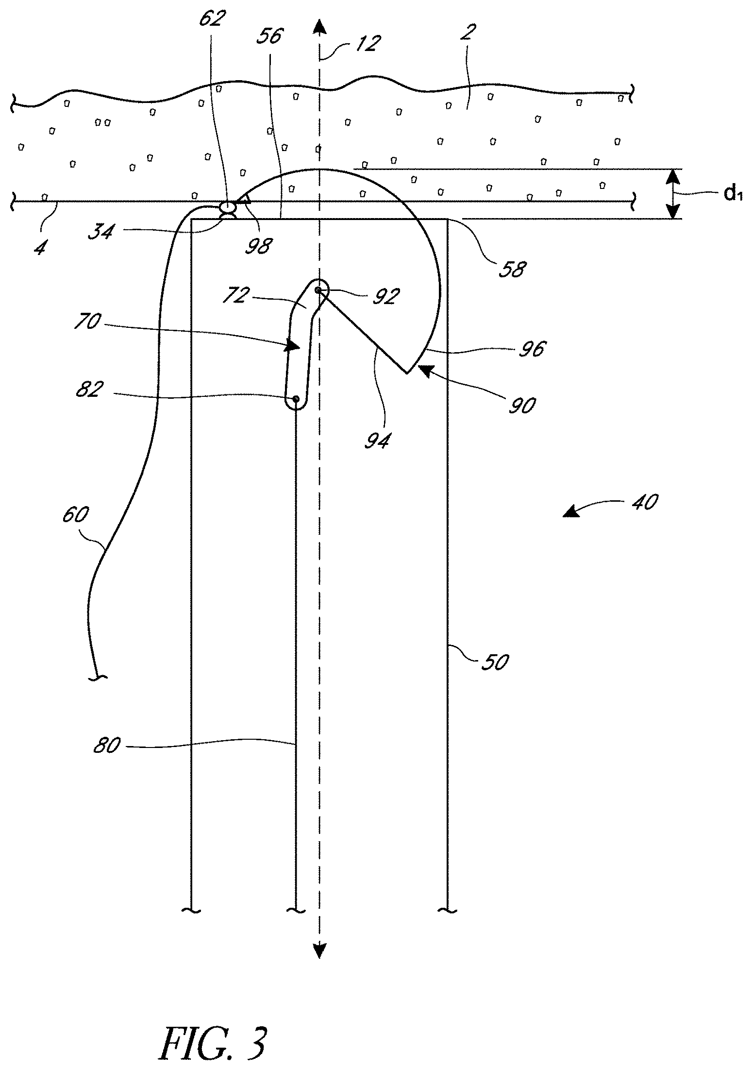 Patent US11779324 Figure 3 – Suturing methods and apparatuses