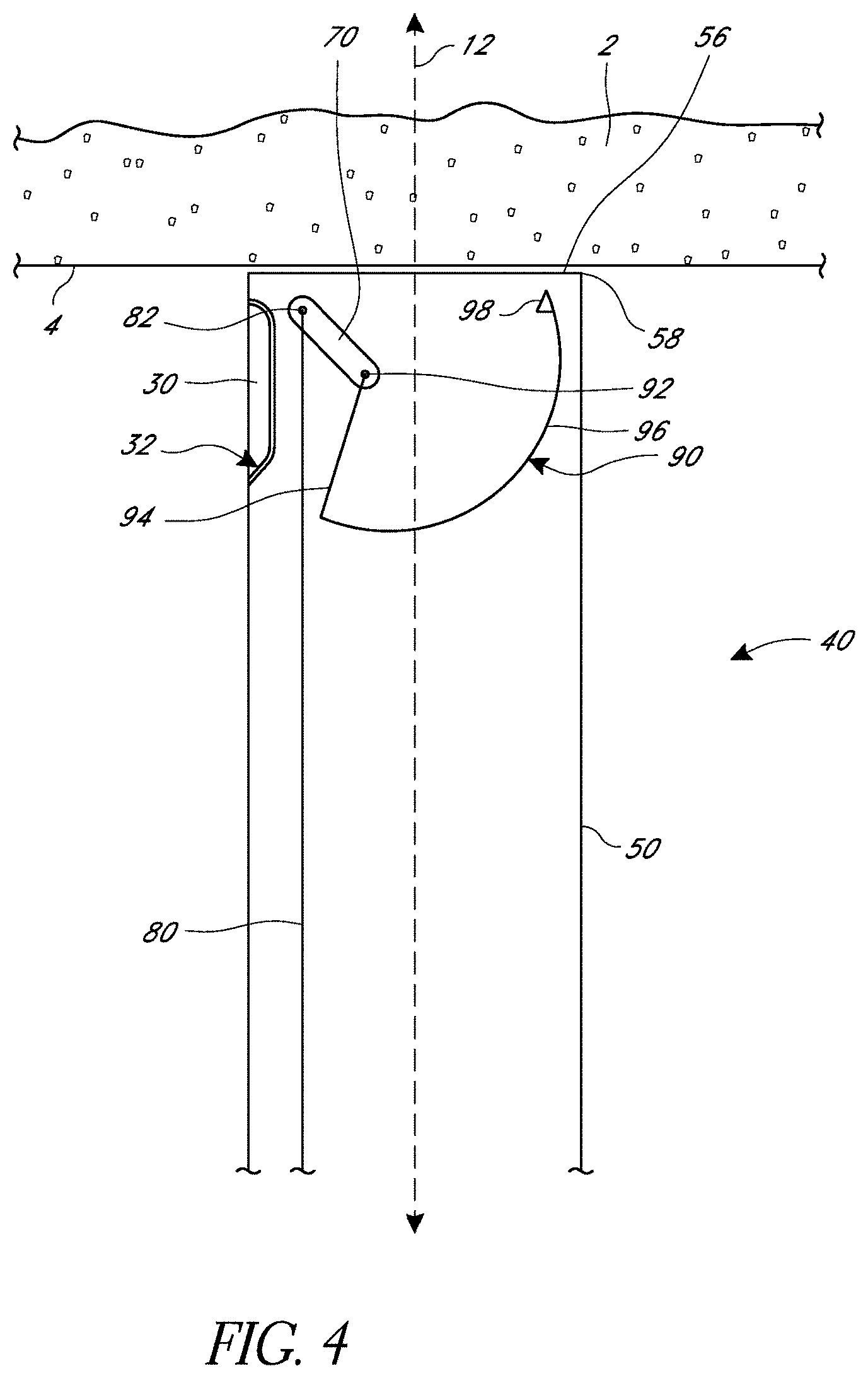 Patent US11779324 Figure 4 – Suturing methods and apparatuses