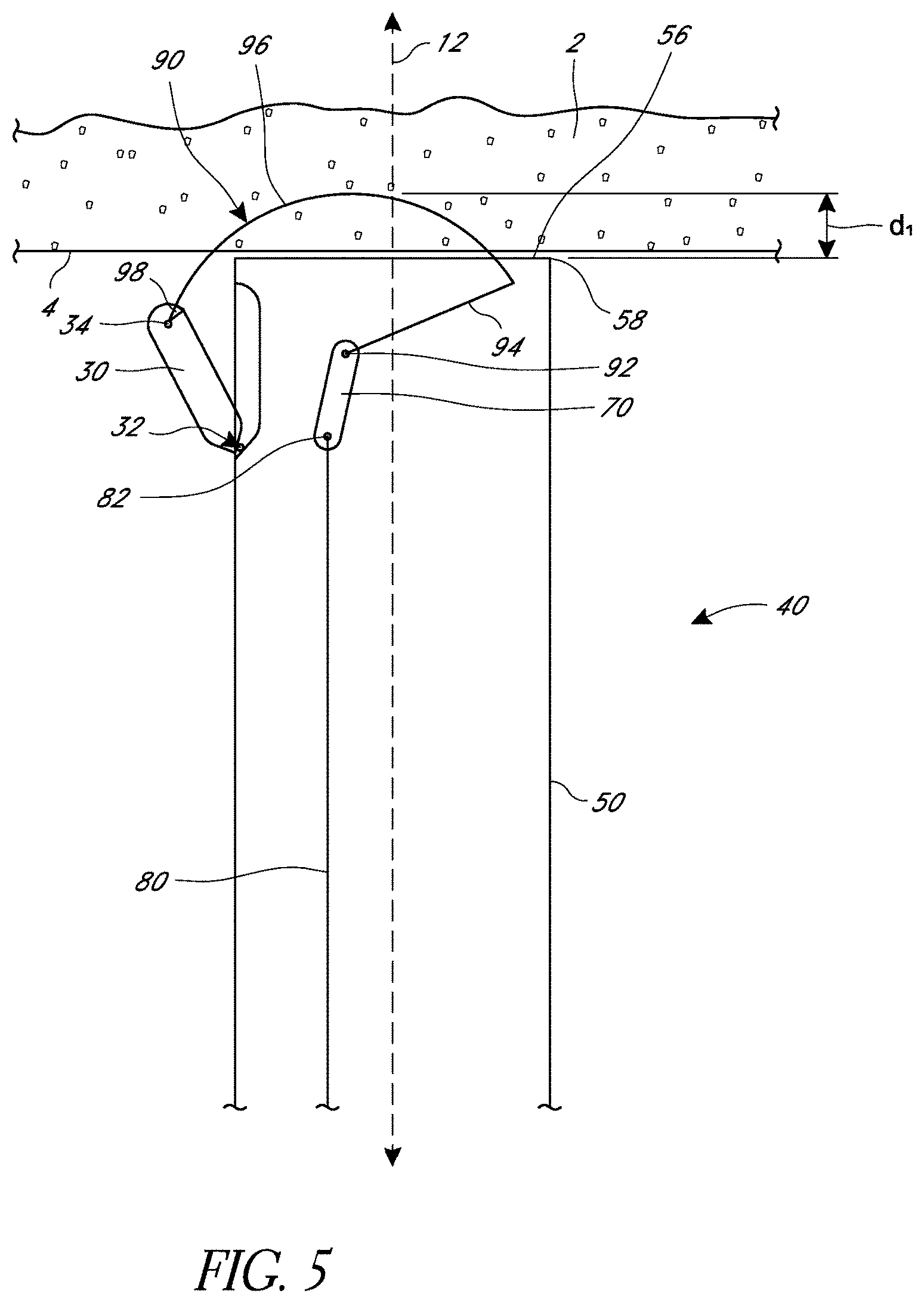 Patent US11779324 Figure 5 – Suturing methods and apparatuses