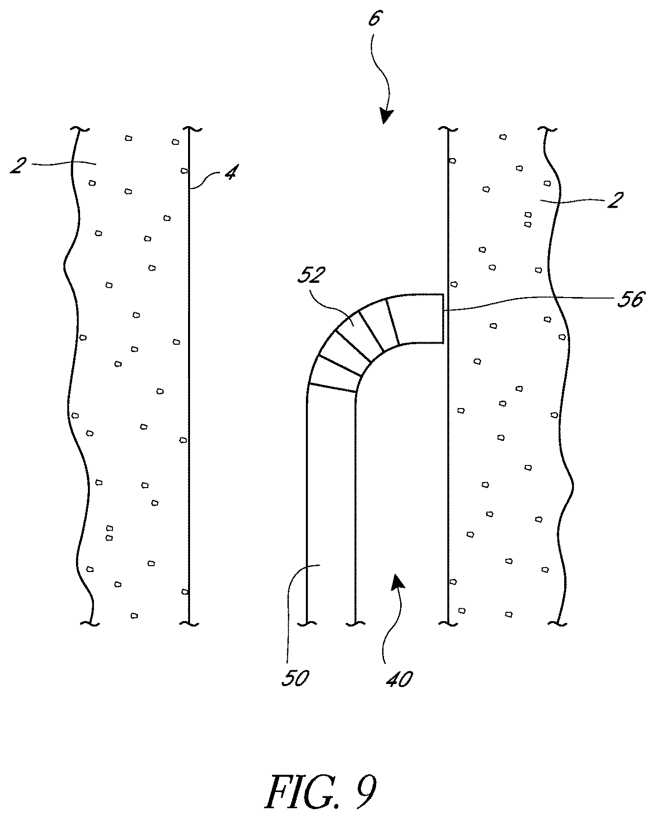 Patent US11779324 Figure 9 – Suturing methods and apparatuses