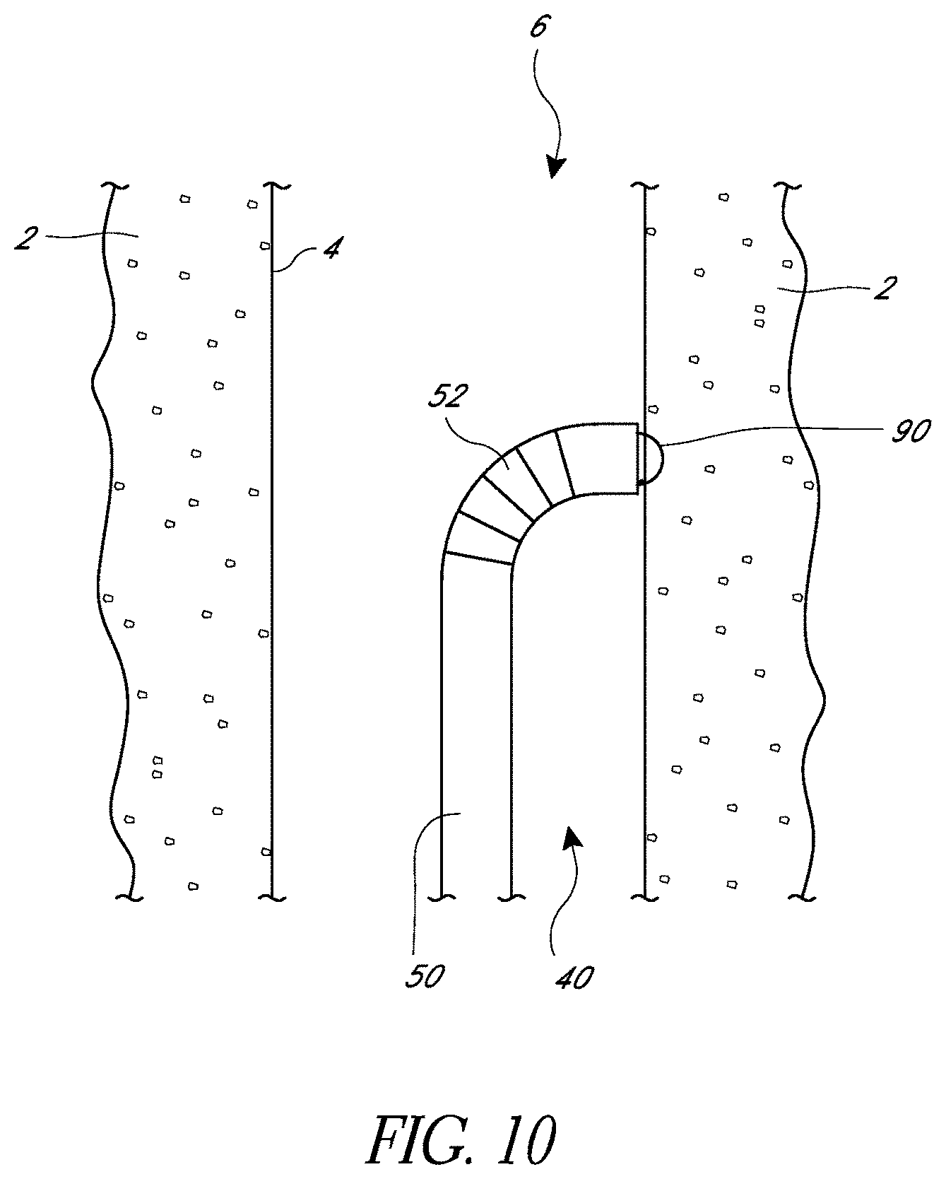 Patent US11779324 Figure 10 – Suturing methods and apparatuses