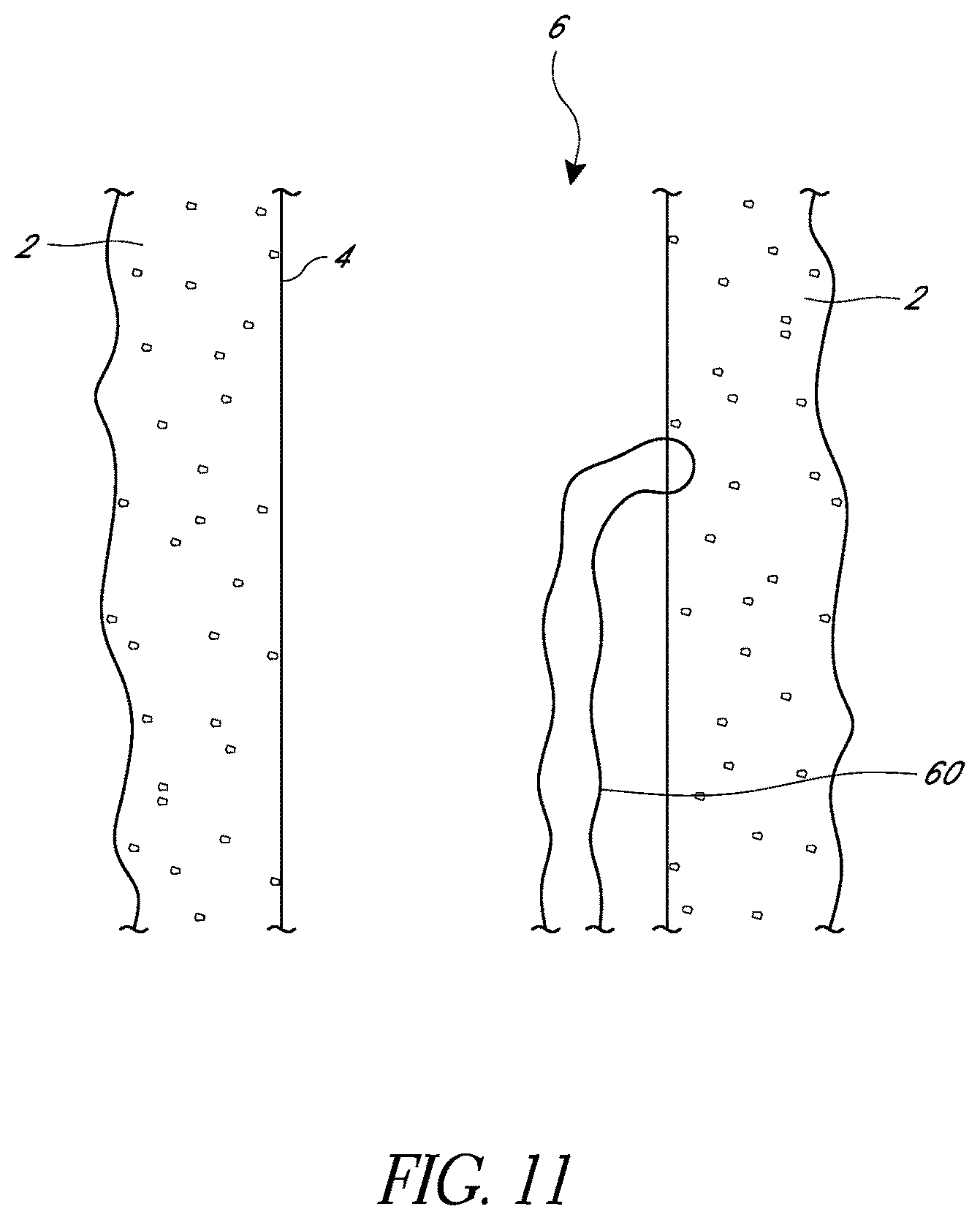 Patent US11779324 Figure 11 – Suturing methods and apparatuses