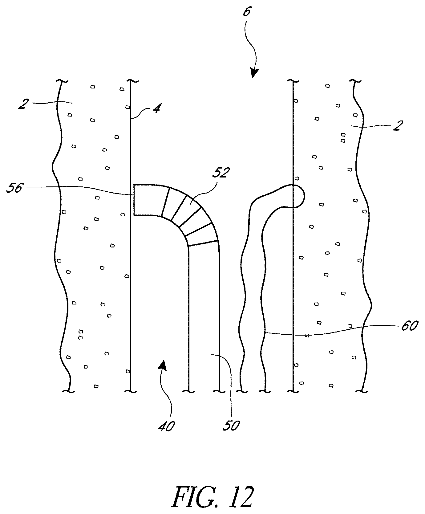 Patent US11779324 Figure 12 – Suturing methods and apparatuses