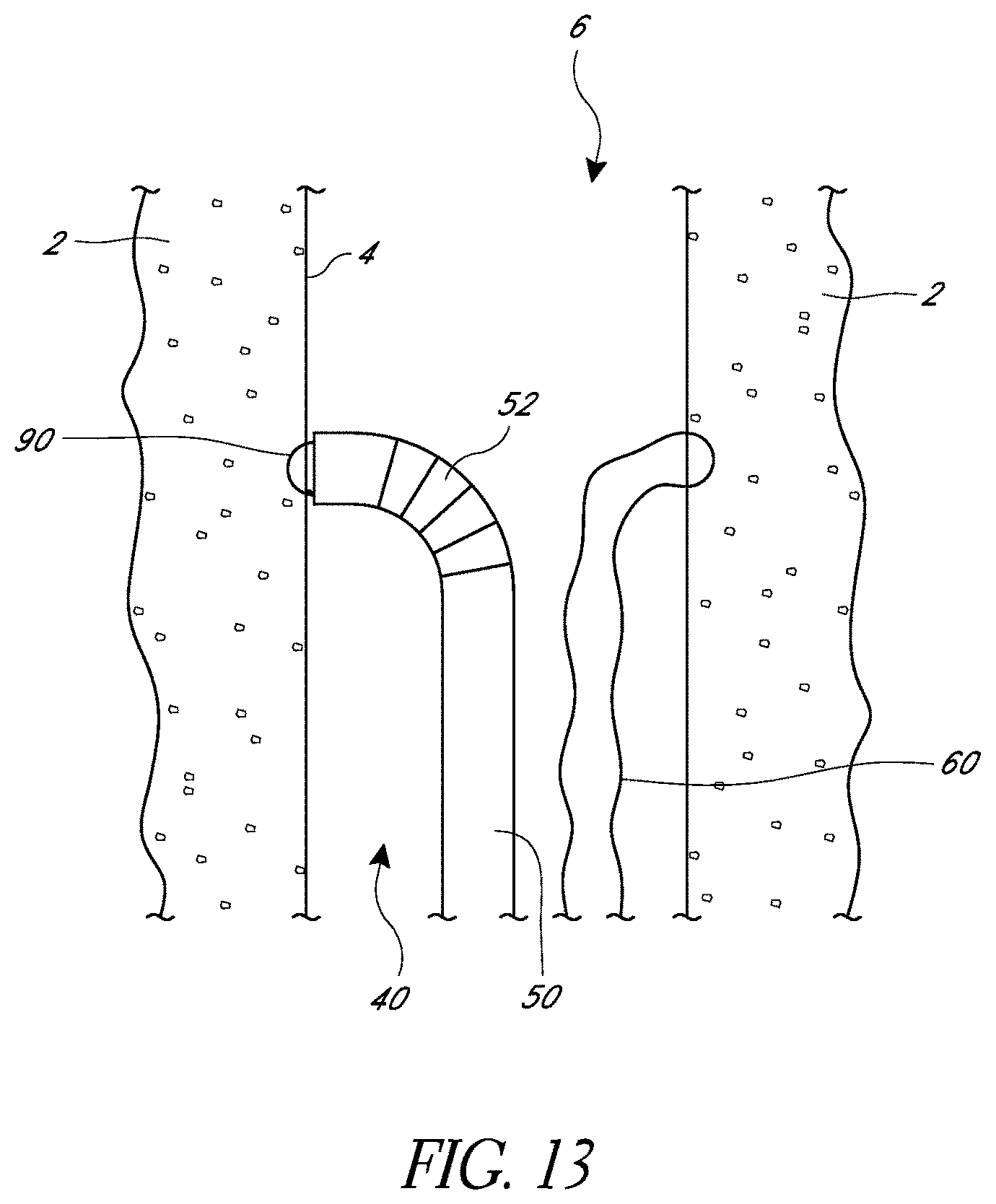 Patent US11779324 Figure 13 – Suturing methods and apparatuses